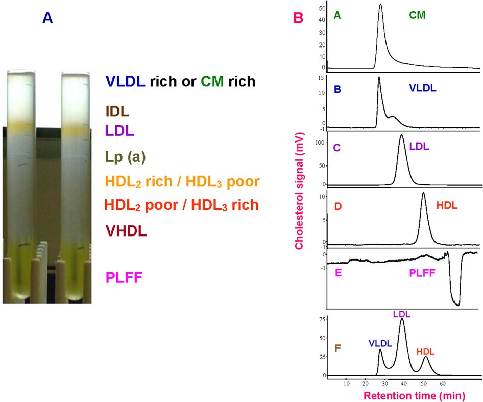 Vldl Cholesterol Levels Chart