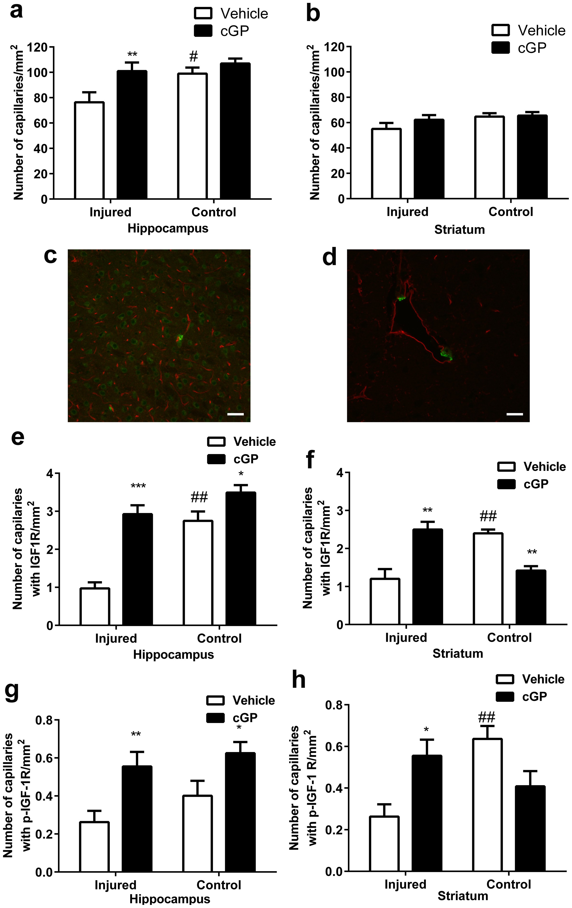 Cyclic glycine-proline regulates IGF-1 homeostasis by altering the binding  of IGFBP-3 to IGF-1 | Scientific Reports