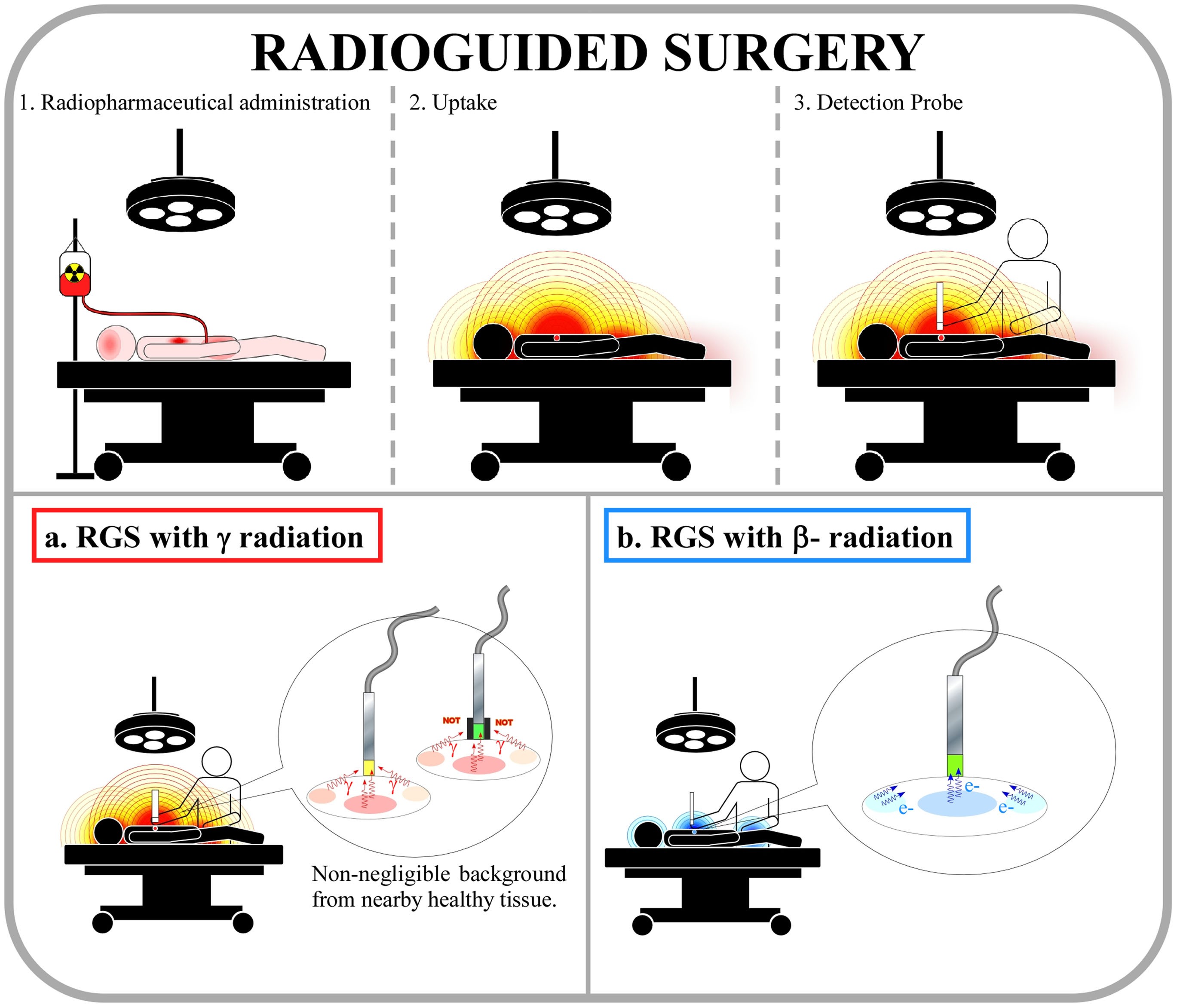 A novel radioguided surgery technique exploiting β− decays | Scientific  Reports