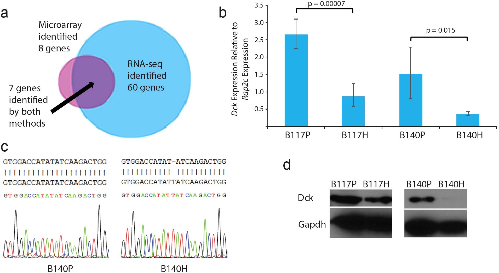Rewiring of the 3D genome during acquisition of carboplatin resistance in a  triple-negative breast cancer patient-derived xenograft
