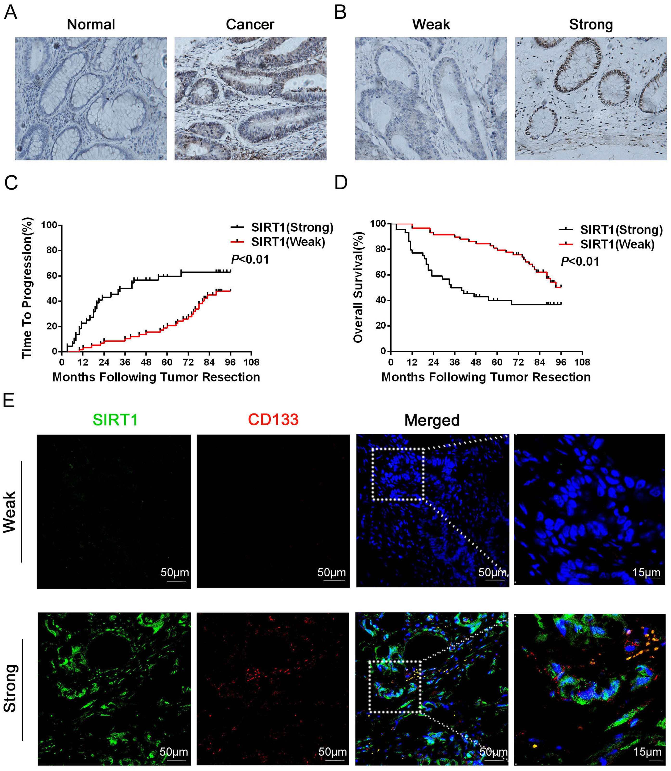 High Levels Of Sirt1 Expression Enhance Tumorigenesis And Associate With A Poor Prognosis Of Colorectal Carcinoma Patients Scientific Reports High Levels Of Sirt1 Expression Enhance Tumorigenesis And Associate With A Poor Prognosis Of Colorectal Carcinoma Patients Scientific Reports
