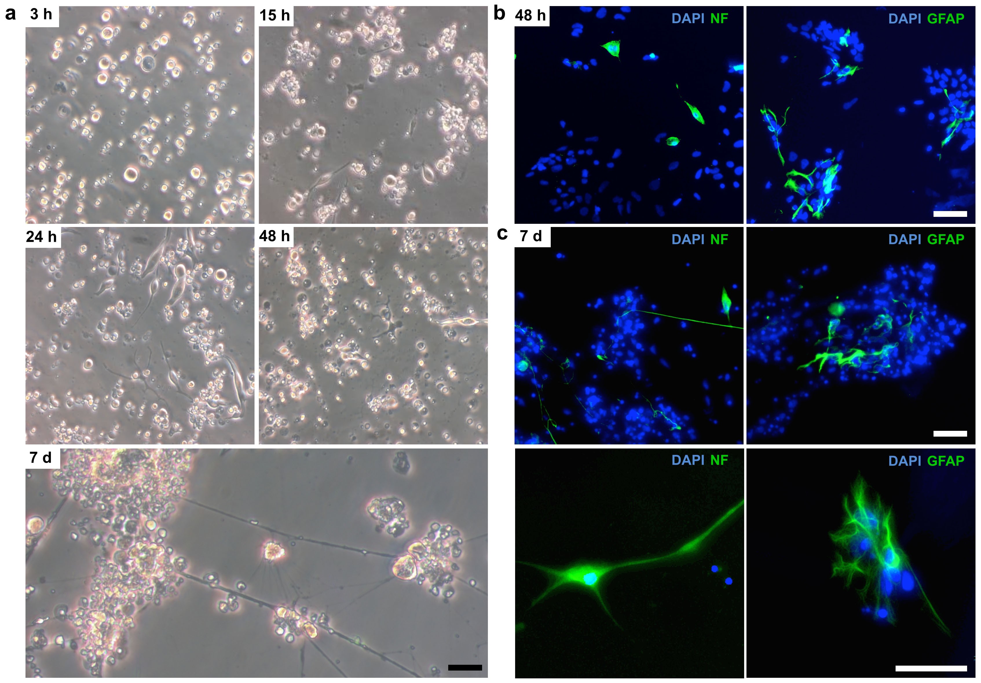 Magnetic-activated cell sorting (MACS) can be used as a large-scale method  for establishing zebrafish neuronal cell cultures | Scientific Reports