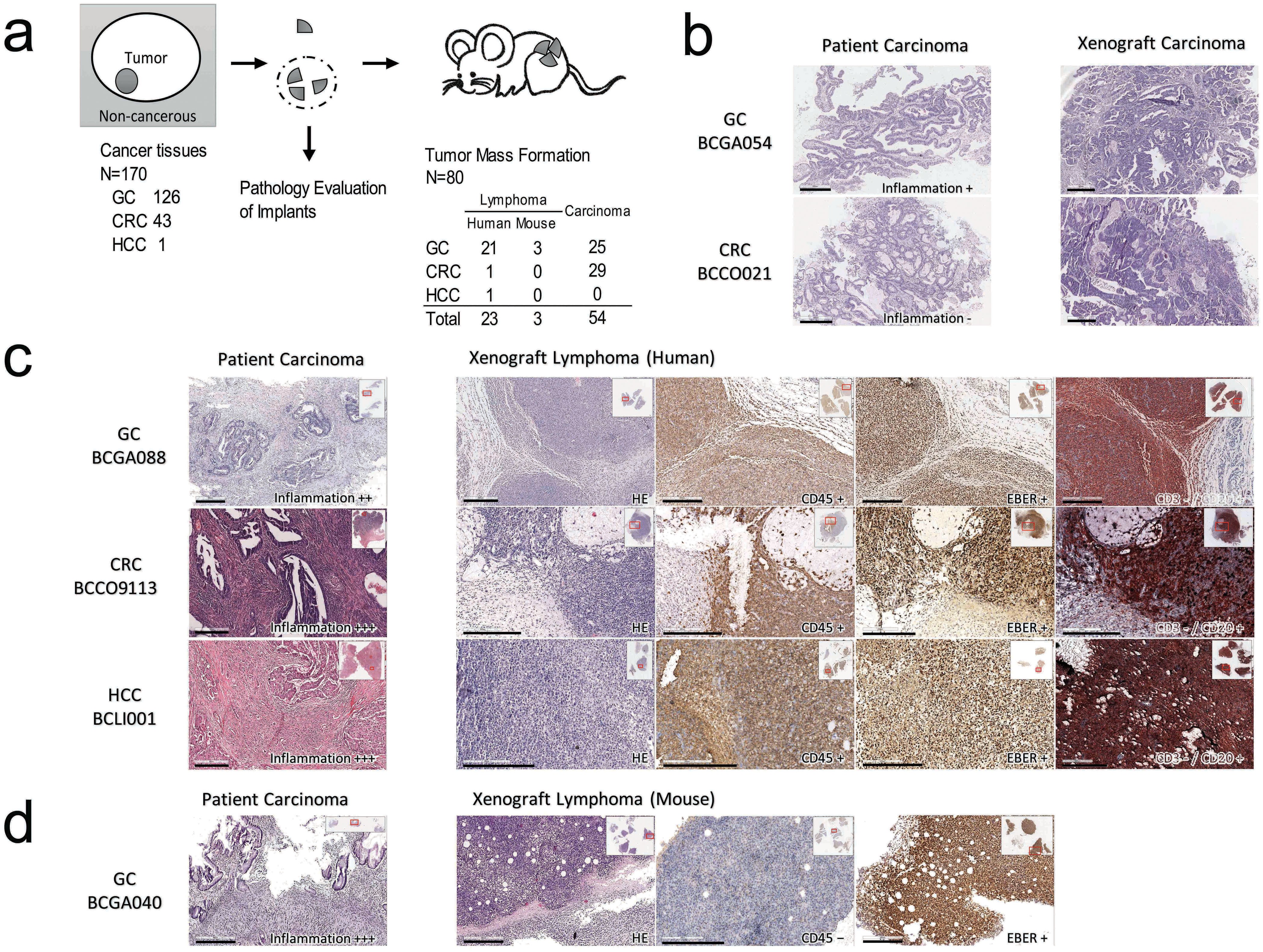 The extent of inflammatory infiltration in primary cancer tissues is  associated with lymphomagenesis in immunodeficient mice | Scientific Reports