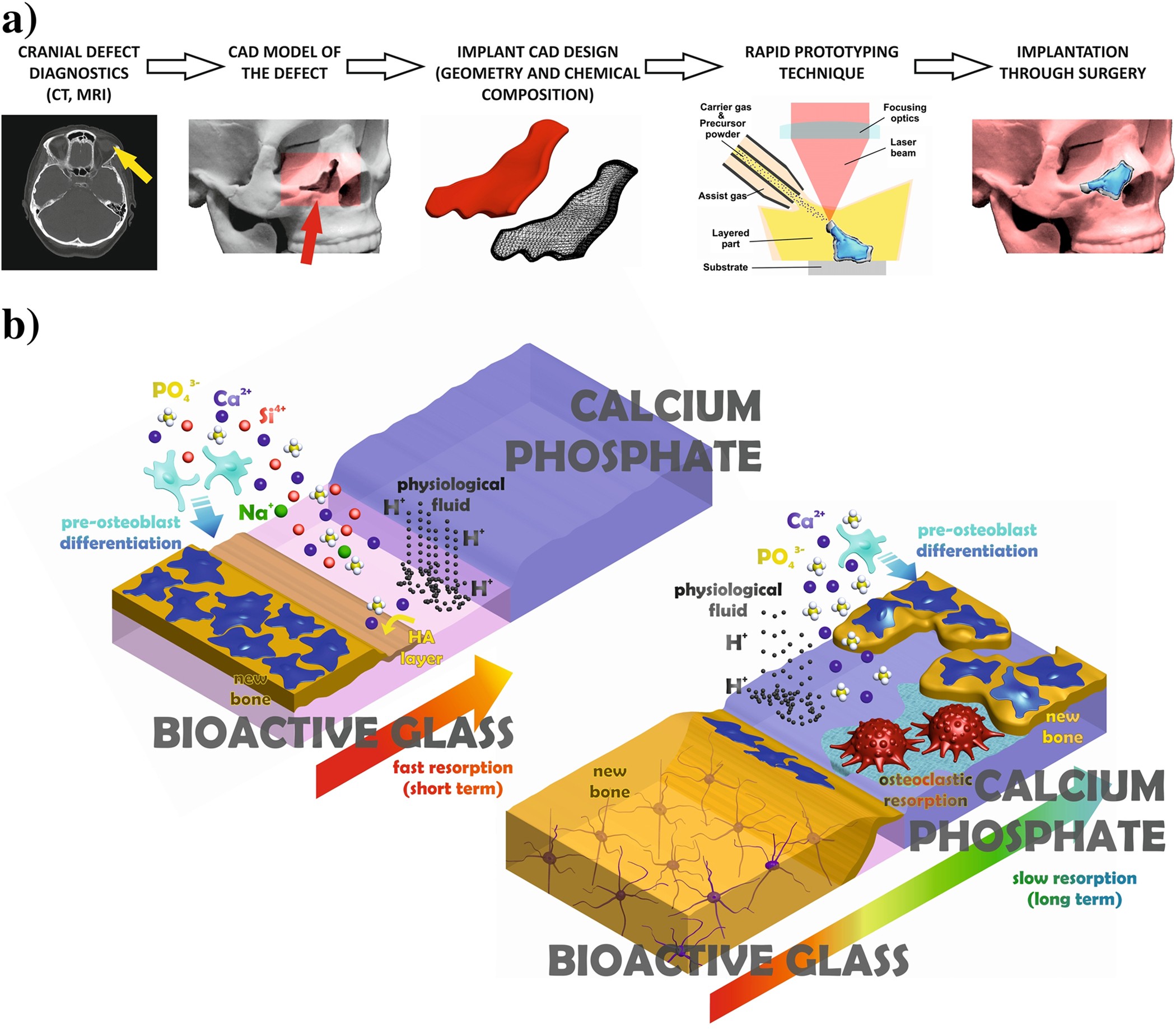 Toward Smart Implant Synthesis: Bonding Bioceramics of Different  Resorbability to Match Bone Growth Rates | Scientific Reports