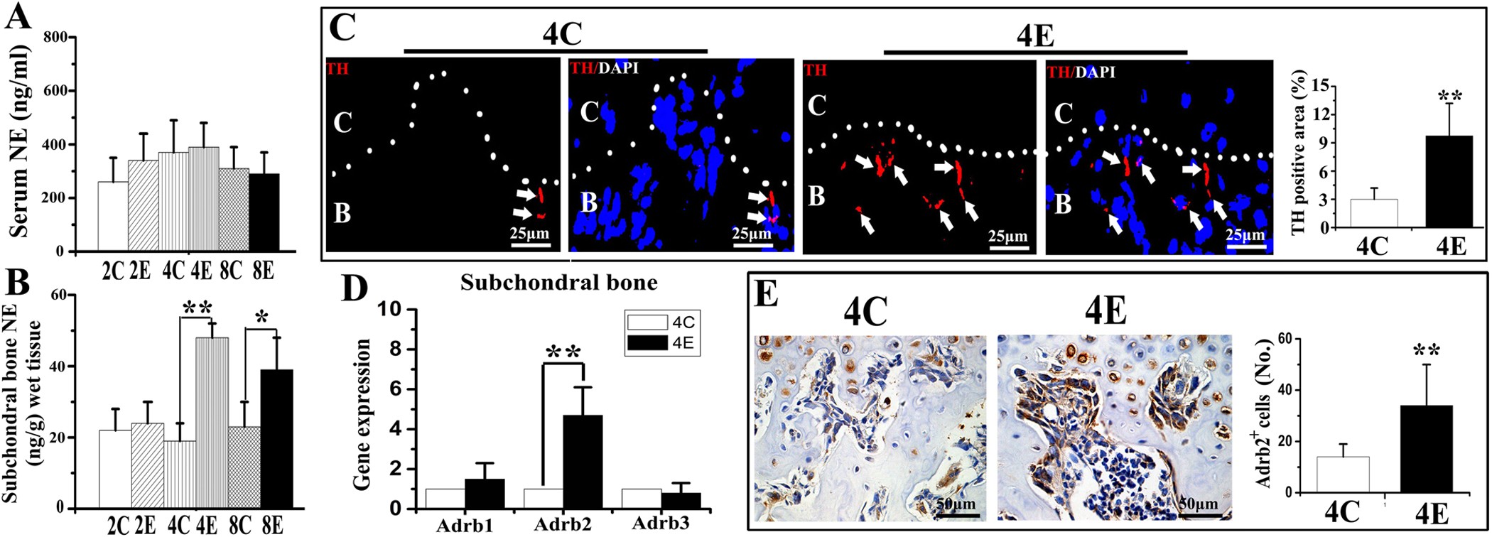 Sightseeing Hændelse gammelklog β2-adrenergic signal transduction plays a detrimental role in subchondral  bone loss of temporomandibular joint in osteoarthritis | Scientific Reports