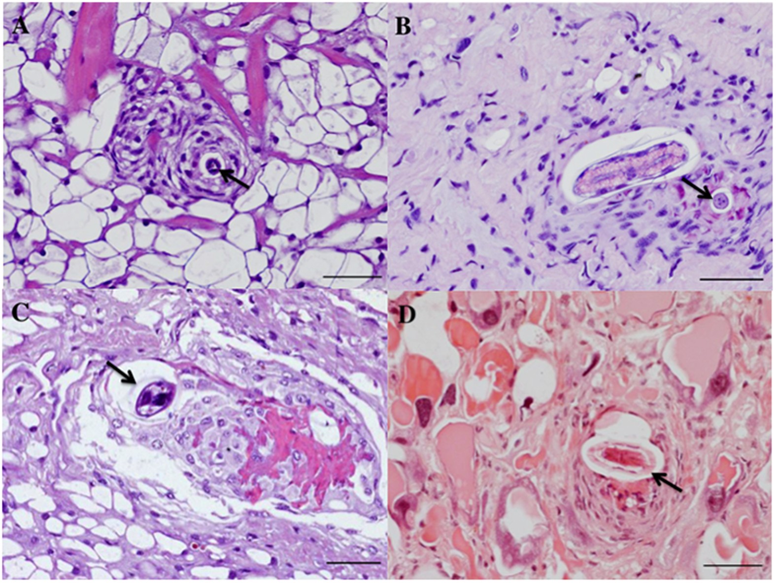 cat lungworm treatment