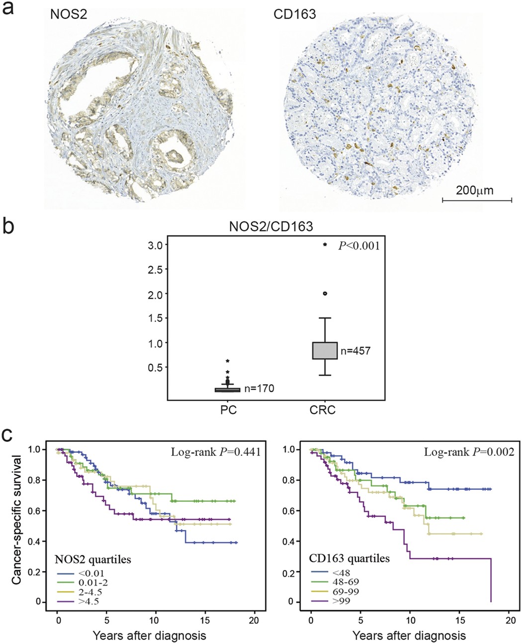 Secreted Factors from Colorectal and Prostate Cancer Cells Skew the Immune  Response in Opposite Directions | Scientific Reports