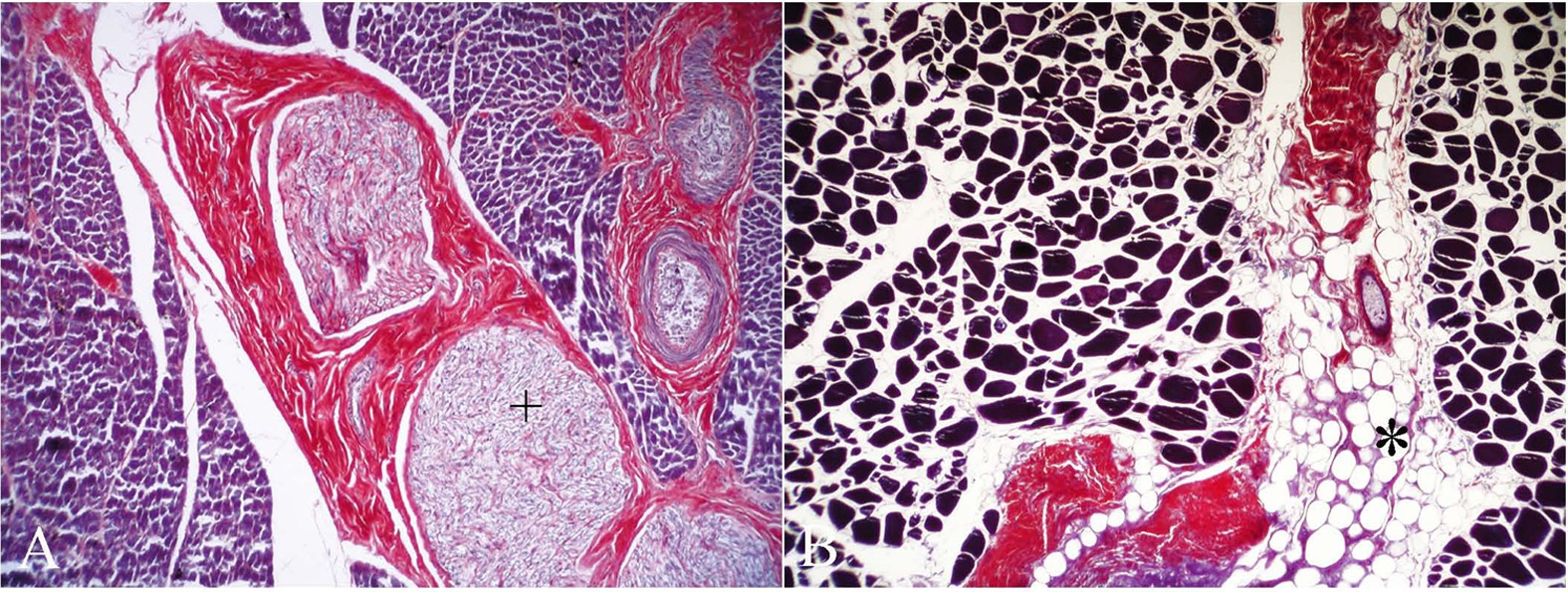 Comparative histology of muscle in free ranging cetaceans: shallow versus  deep diving species