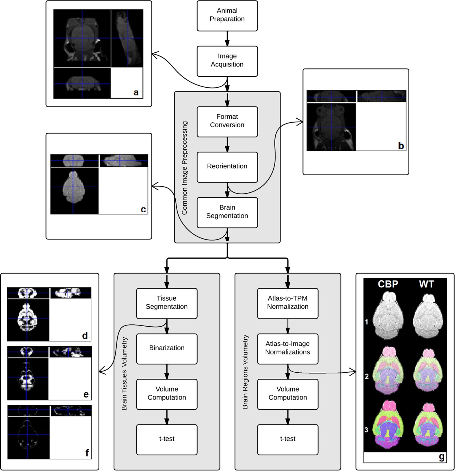 Rubinstein-Taybi Syndrome - GeneReviews® - NCBI Bookshelf