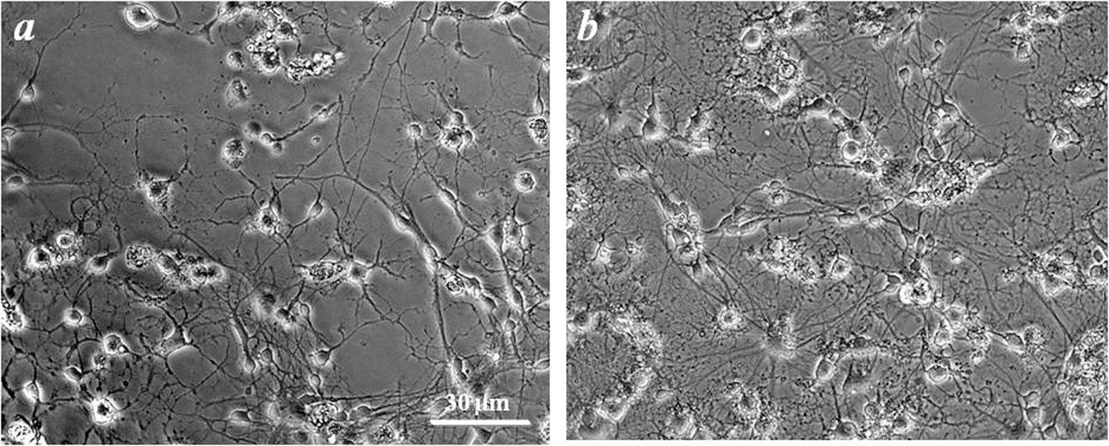 Co-ultramicronized Palmitoylethanolamide/Luteolin Promotes the Maturation  of Oligodendrocyte Precursor Cells | Scientific Reports