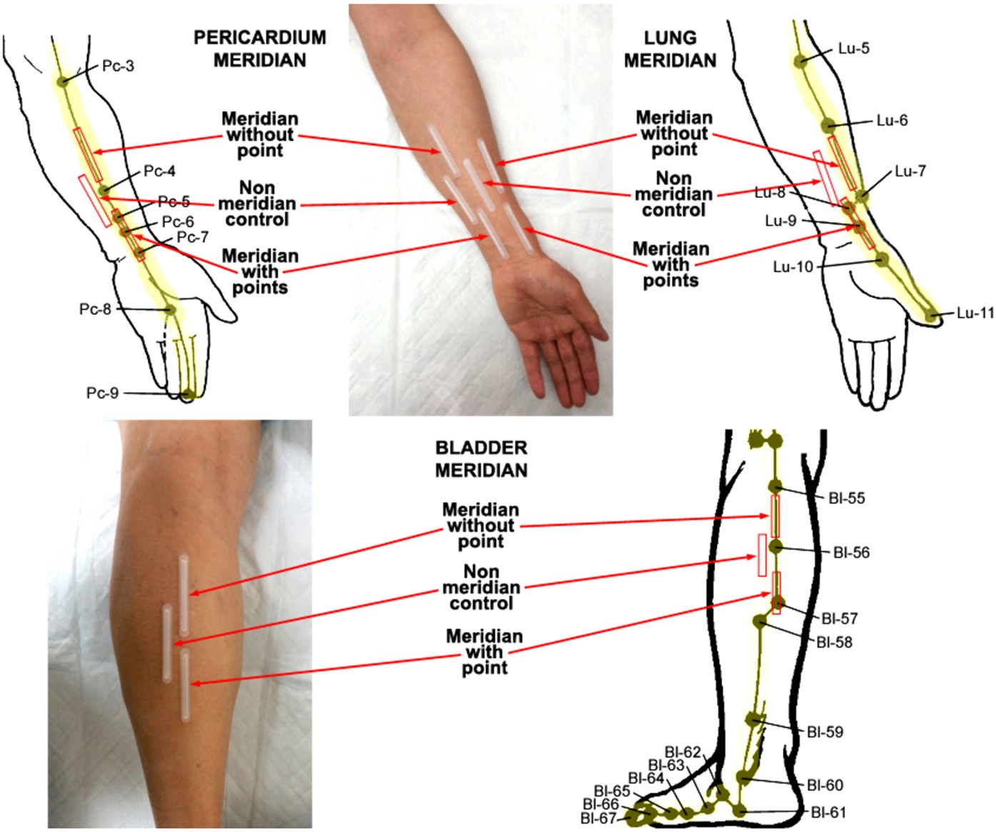 Influence of age, gender and race on nitric oxide release over acupuncture  points-meridians | Scientific Reports