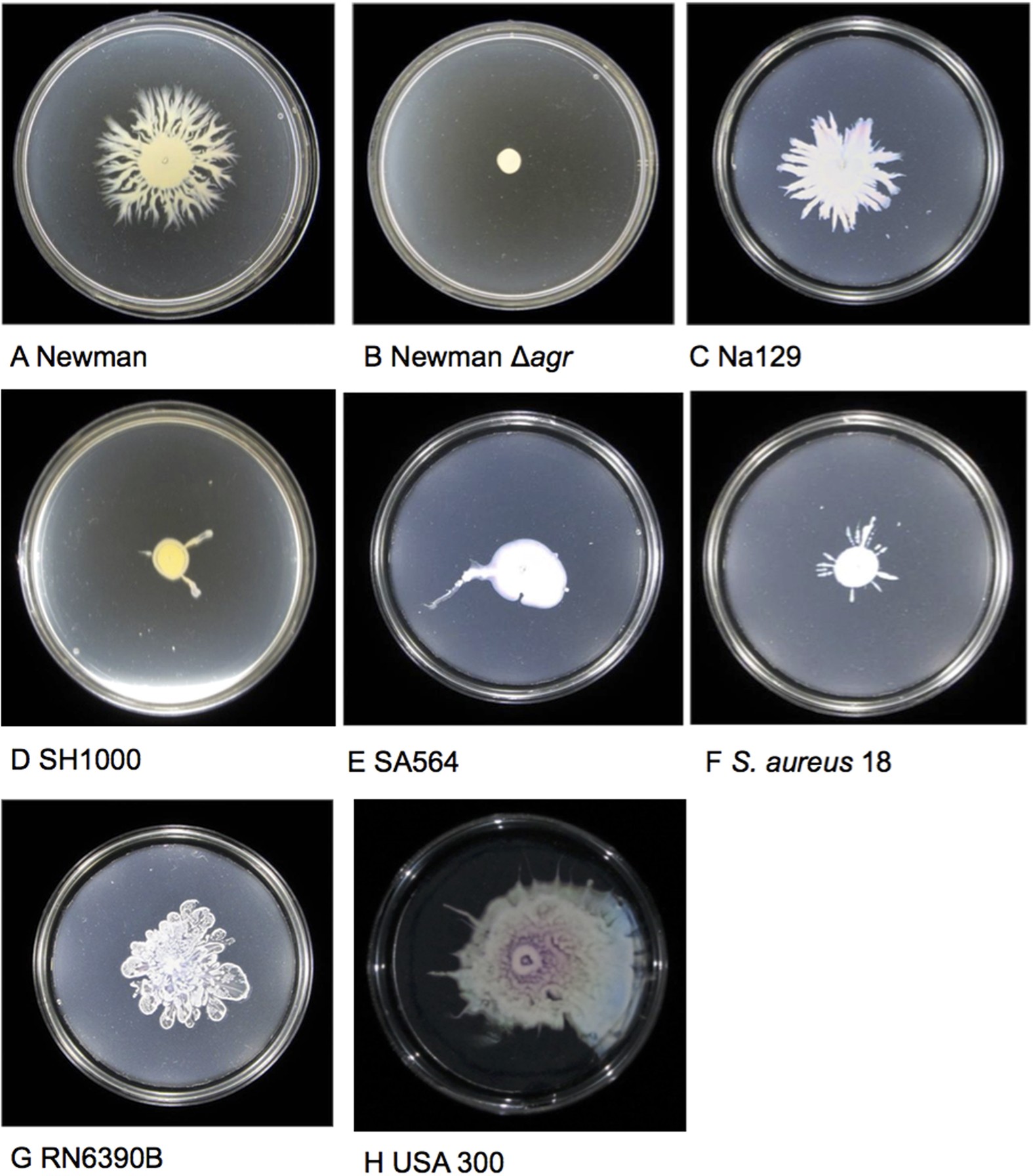 Staphylococcus aureus photo.