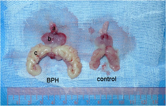 lehet prostatitis 23 c- on