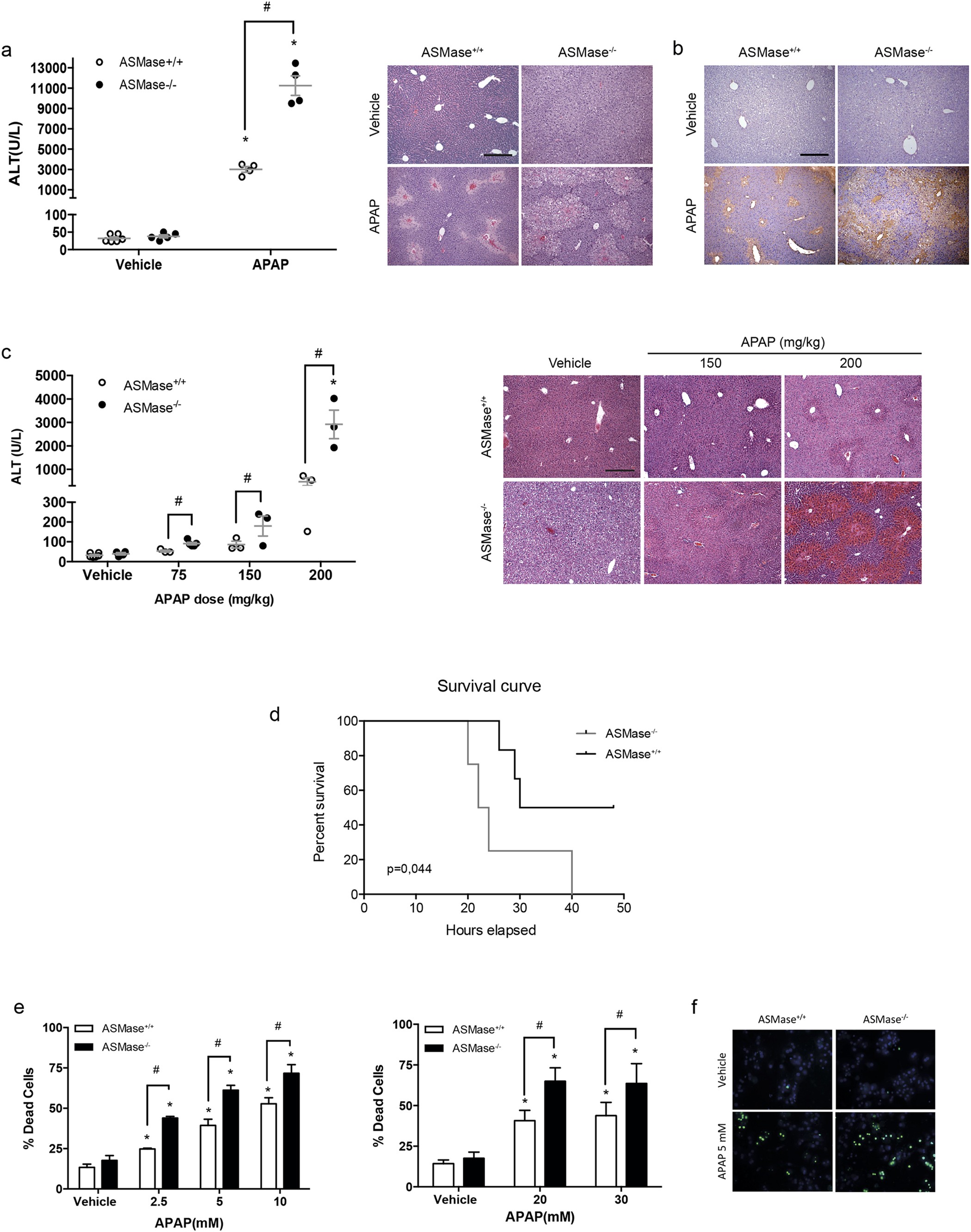 Lysosomal Cholesterol Accumulation Sensitizes To Acetaminophen Hepatotoxicity By Impairing Mitophagy Scientific Reports Lysosomal Cholesterol Accumulation Sensitizes To Acetaminophen Hepatotoxicity By Impairing Mitophagy Scientific Reports