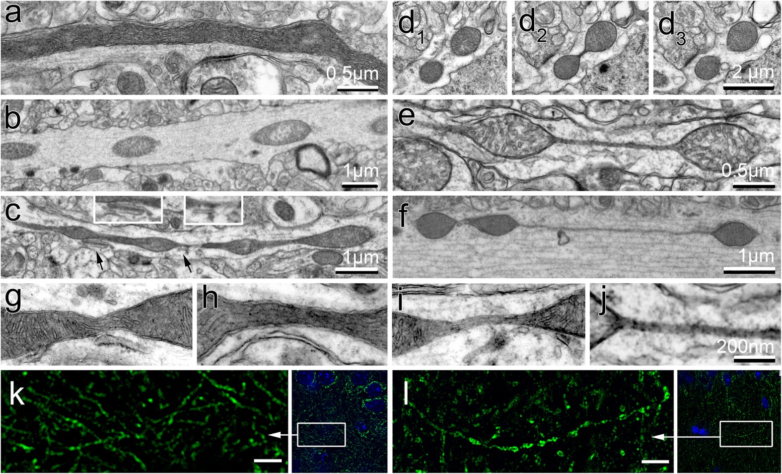 Altered Brain Energetics Induces Mitochondrial Fission Arrest In Alzheimer S Disease Scientific Reports