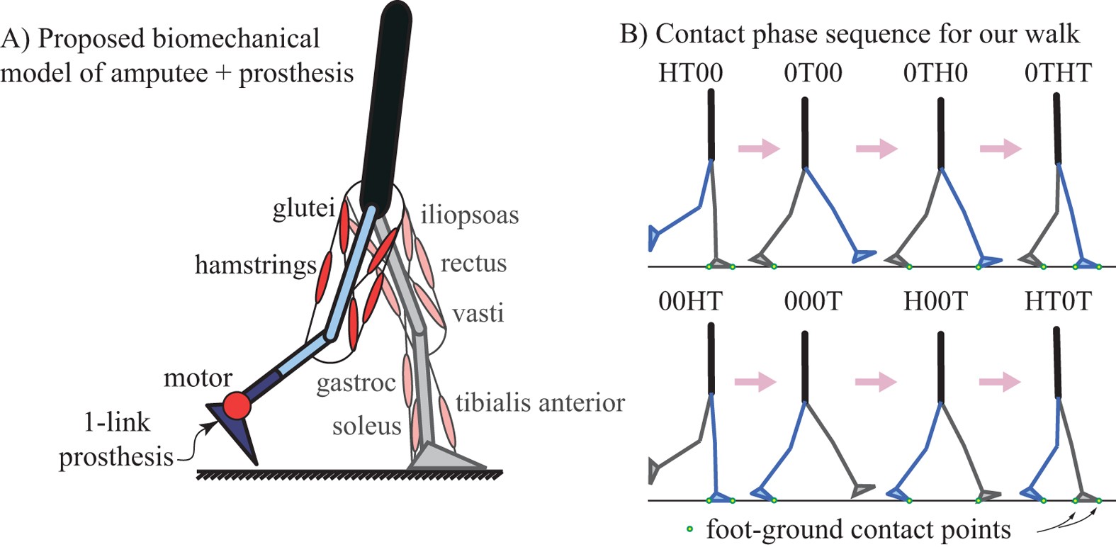 Walking With a Prosthetic Limb - Prosthetic Step Training