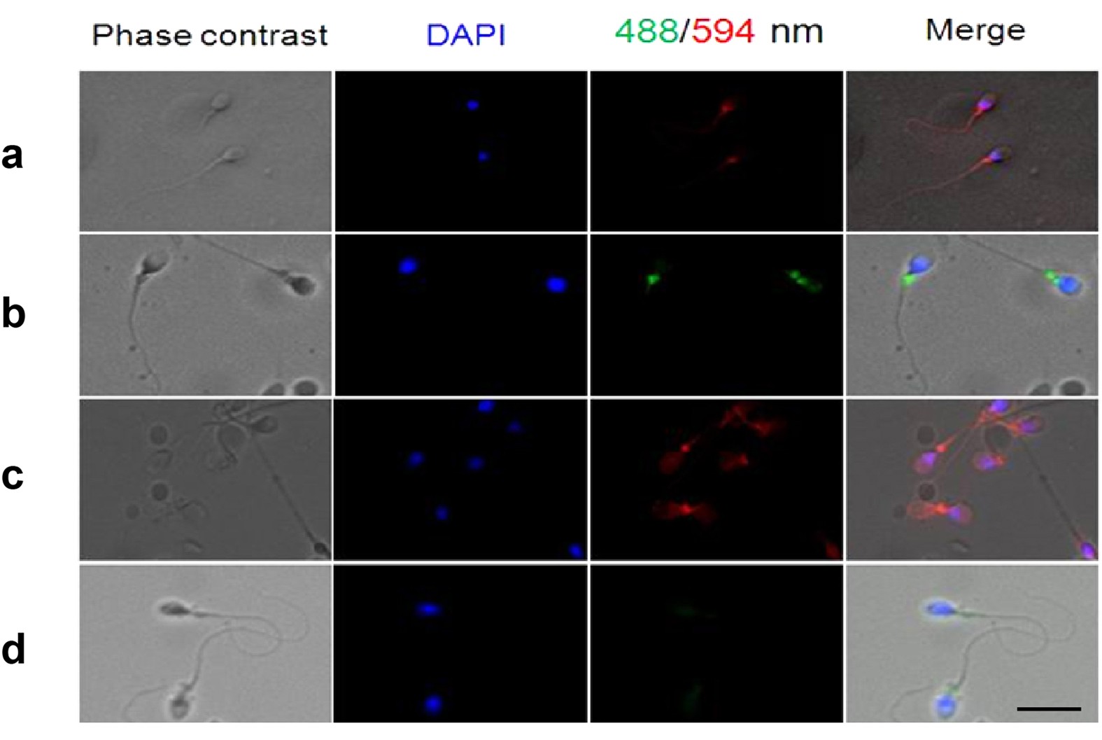 Sperm tween Immunoglobulin G Expression in Human Sperm and Possible Functional  Significance | Scientific Reports