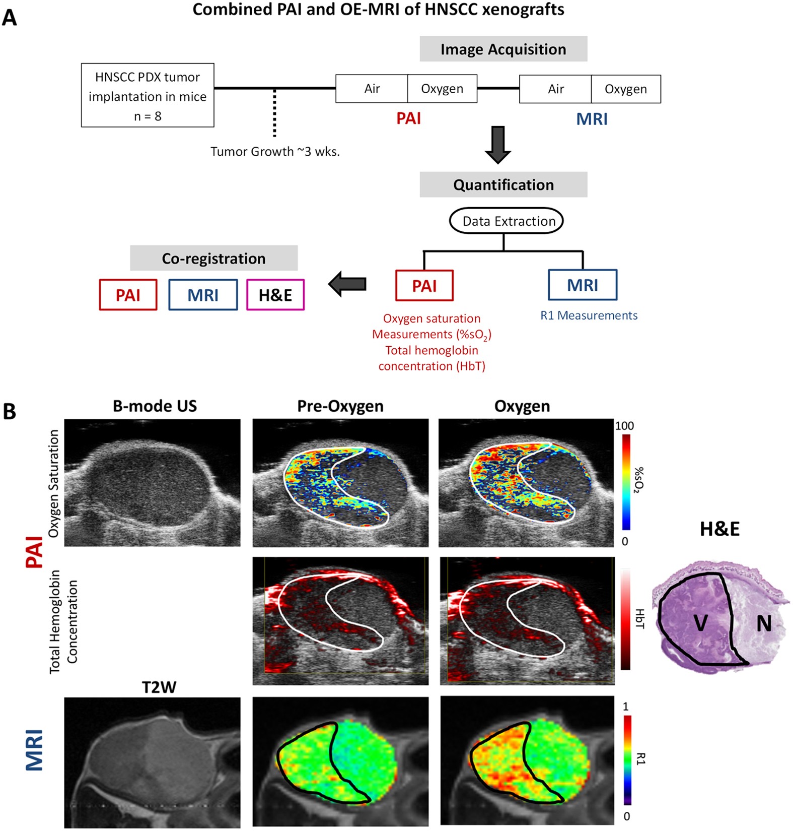 Photoacoustic monitoring of tumor and normal tissue response to radiation |  Scientific Reports