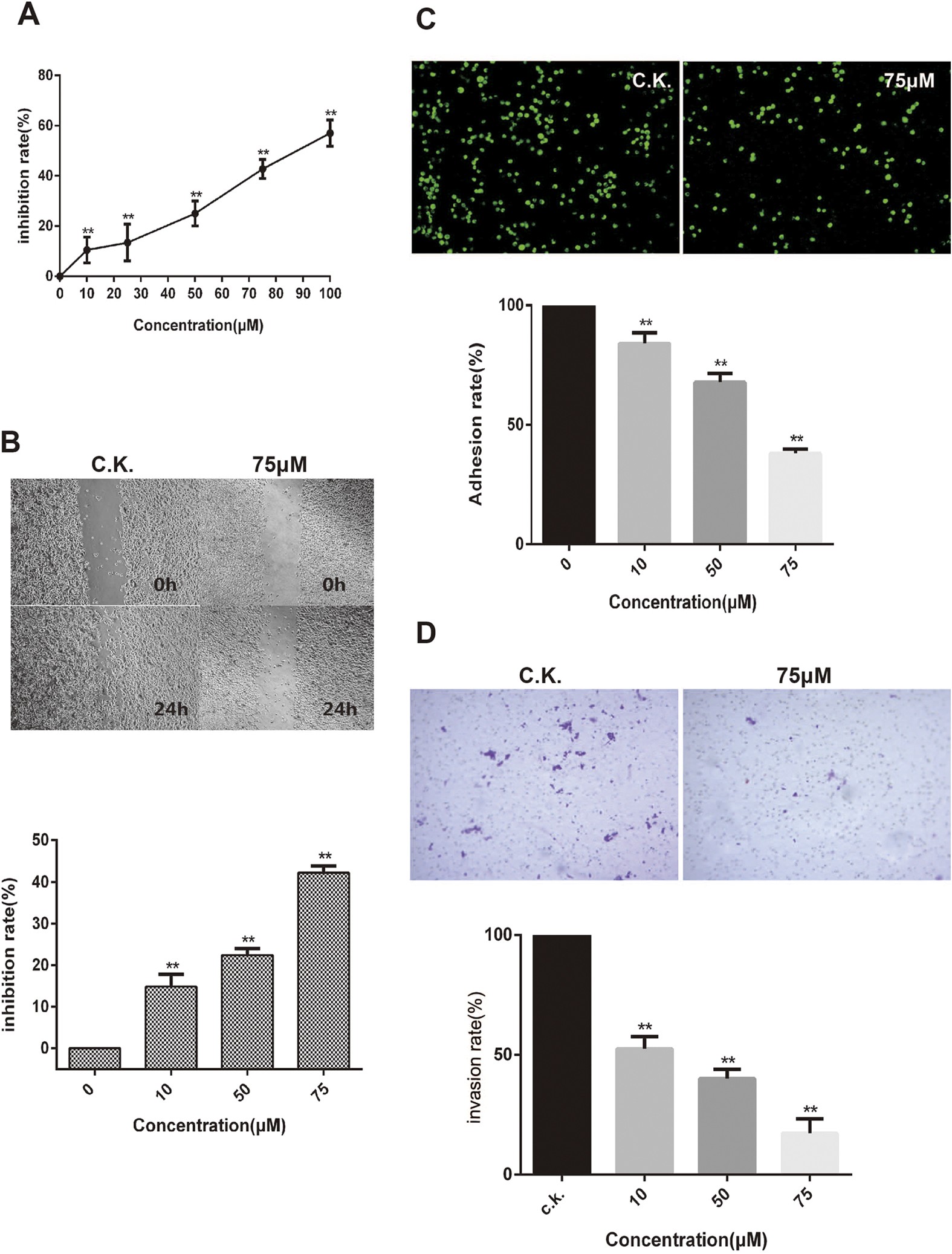 Pharmacoproteomic analysis reveals that metapristone (RU486 metabolite) intervenes E-cadherin and vimentin to realize cancer metastasis chemoprevention Scientific Reports
