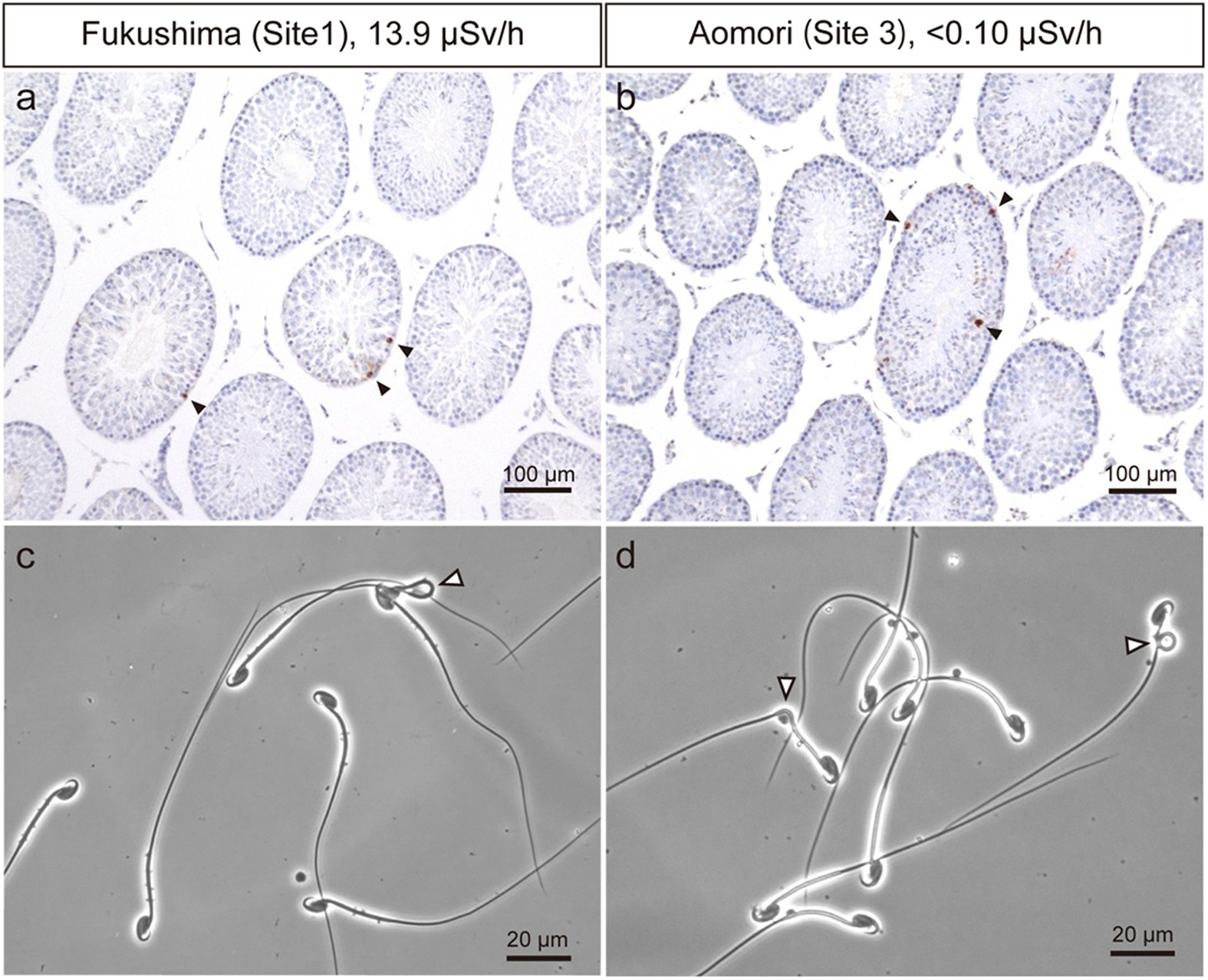 Figure 2: Apoptosis in male germ cells, and morphology of epididymal spermatozoa in wild large Japanese field mice captured at Fukushima (Site 1) and Aomori (Site 3) in 2013.