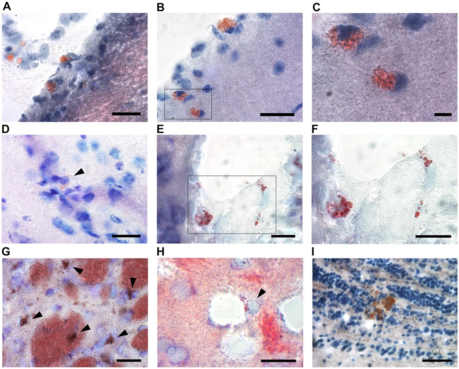 Lipid Laden Cells Differentially Distributed In The Aging Brain Are Functionally Active And Correspond To Distinct Phenotypes Scientific Reports