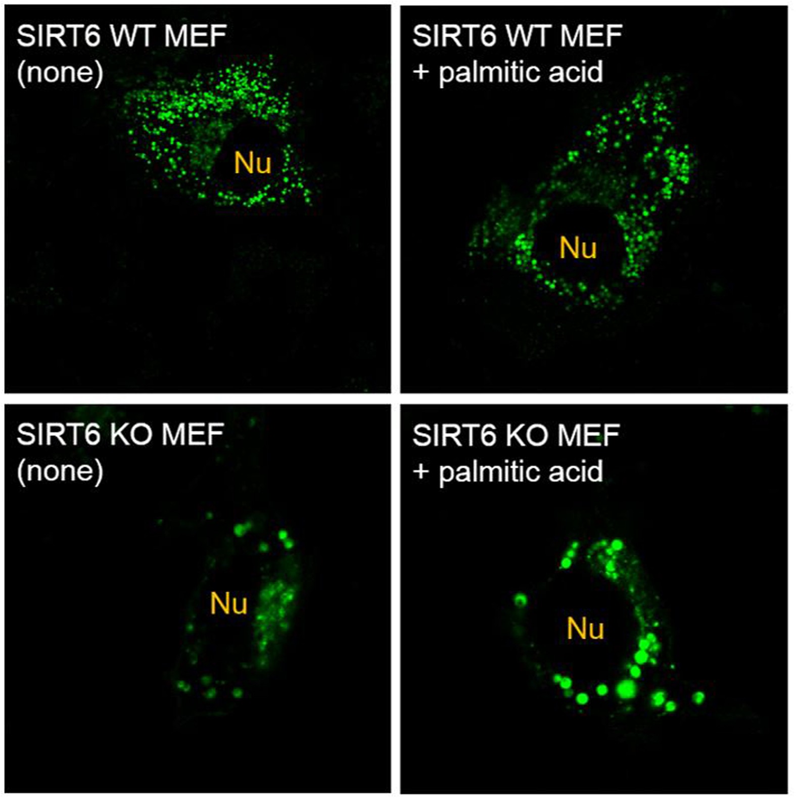 Lysine Fatty Acylation Promotes Lysosomal Targeting Of Tnf α