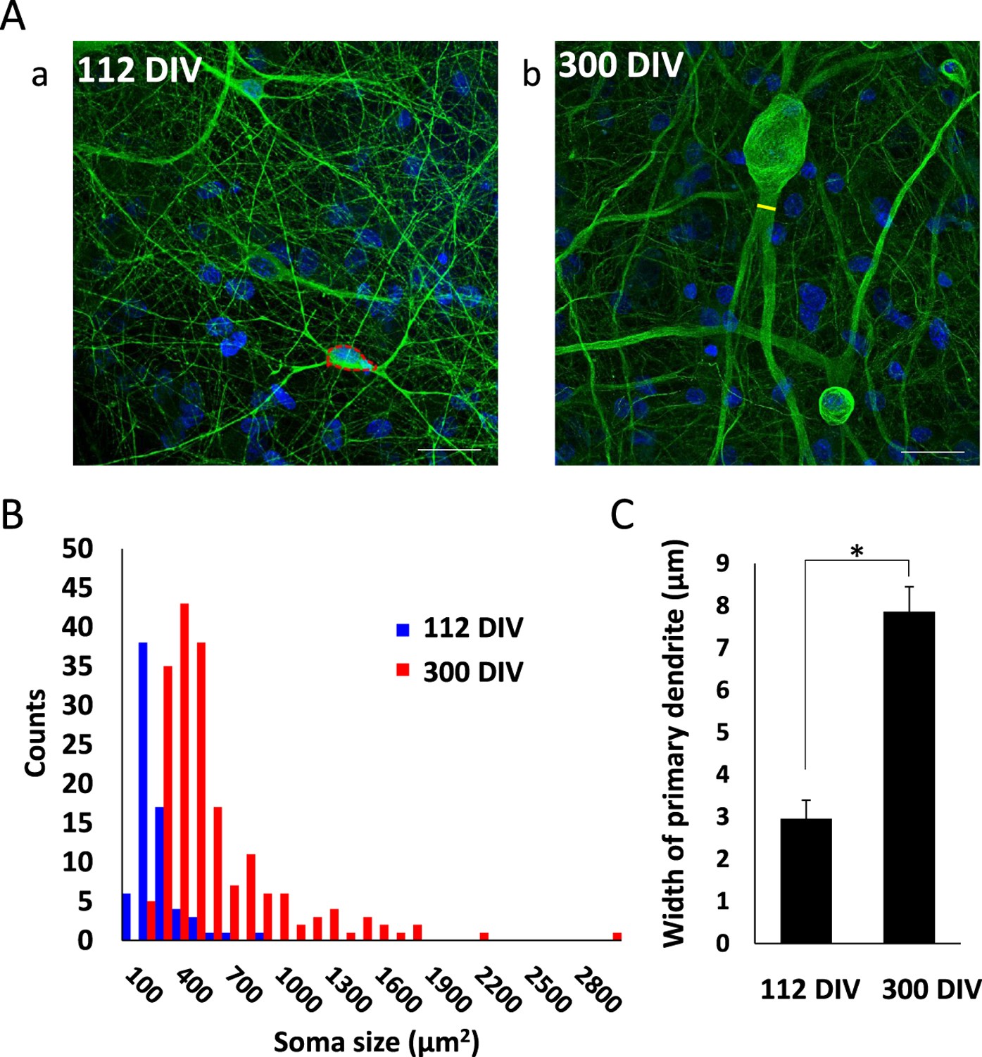 Neurons-on-a-Chip for Drug Development & Neurotoxicity