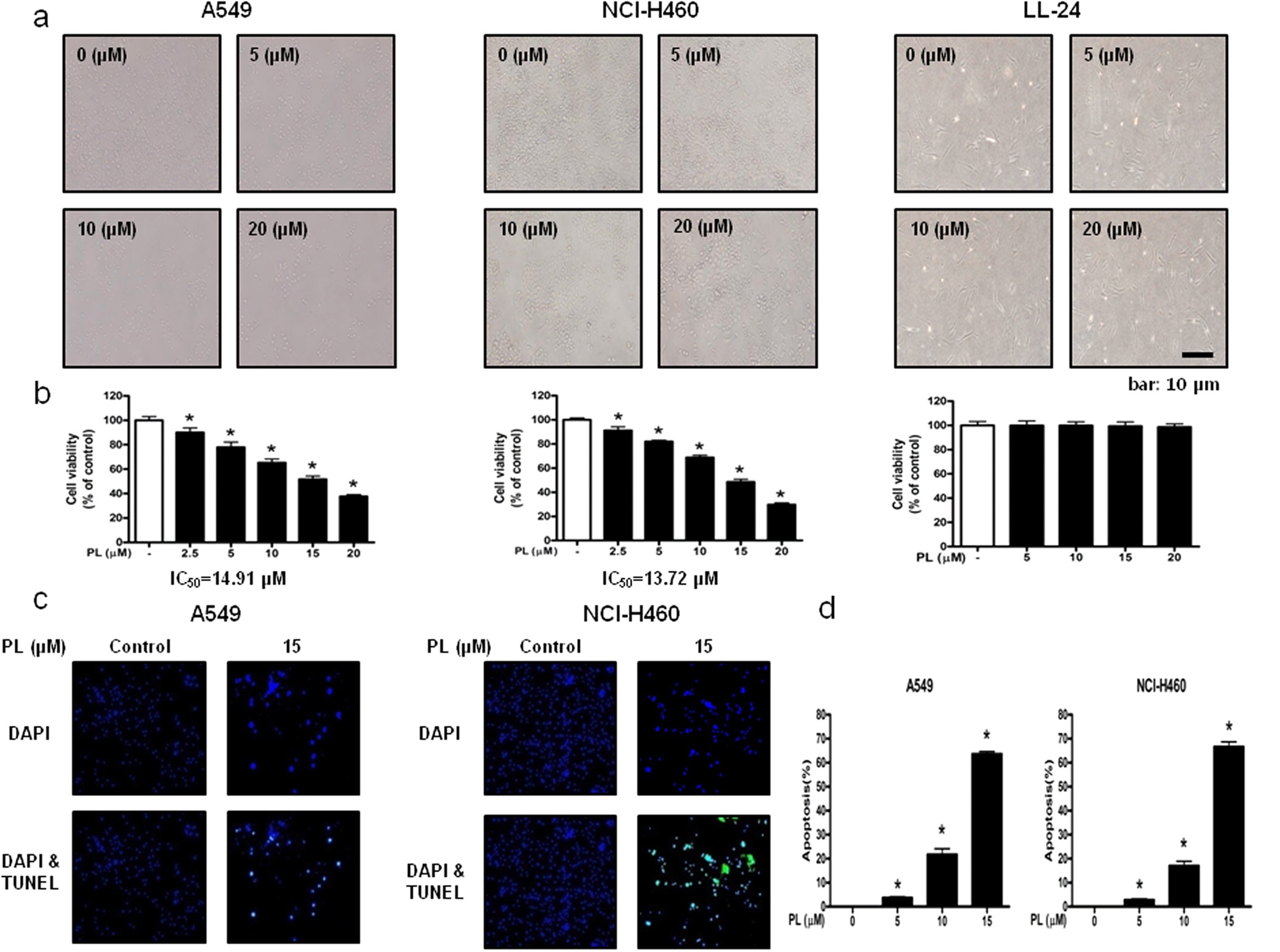 Piperlongumine Inhibits Lung Tumor Growth Via Inhibition Of Nuclear Factor Kappa B Signaling Pathway Scientific Reports