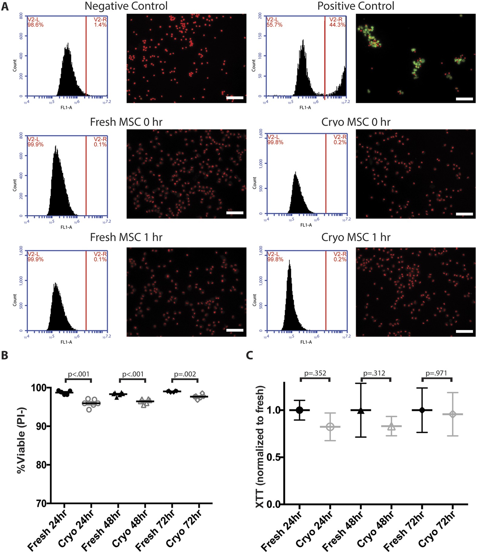 Cryopreserved Mesenchymal Stromal Cells Maintain Potency In A Retinal Ischemia Reperfusion Injury Model Toward An Off The Shelf Therapy Scientific Reports