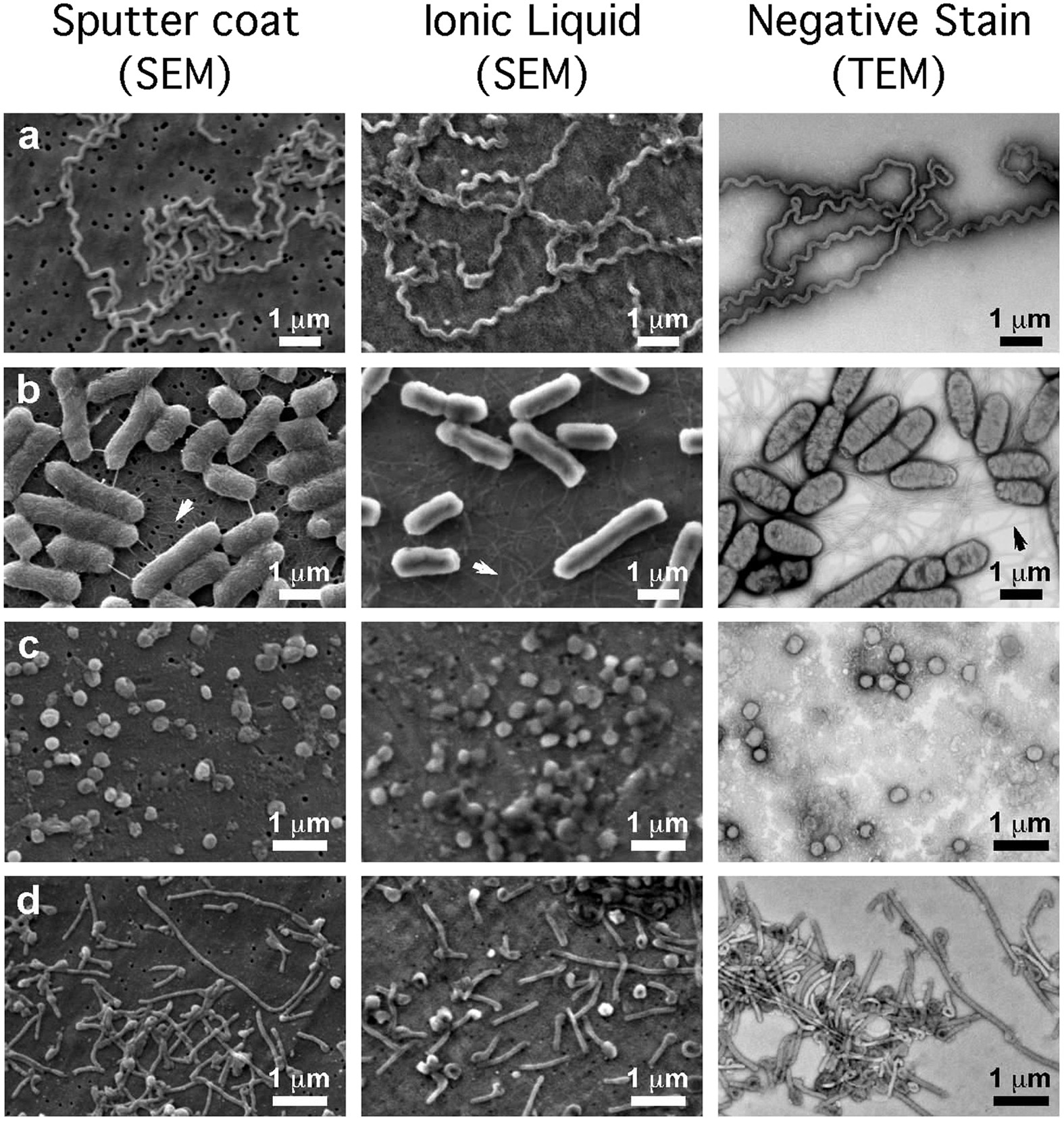 The scanning electron microscope in microbiology and diagnosis of  infectious disease | Scientific Reports