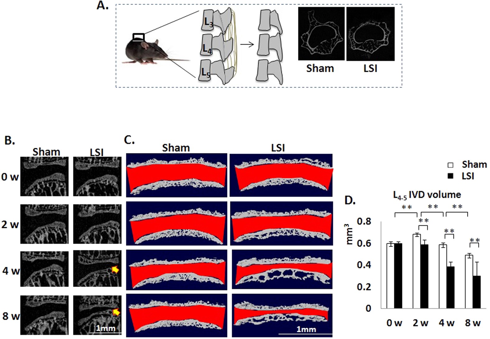 Excessive Activation of TGFβ by Spinal Instability Causes Vertebral Endplate  Sclerosis | Scientific Reports