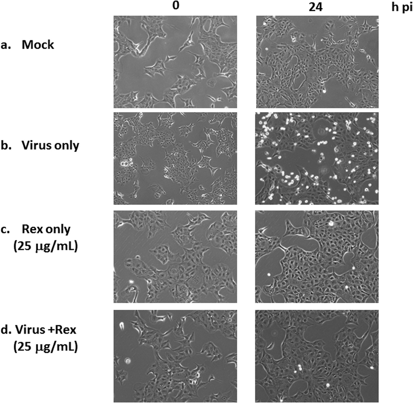 Inhibition of endosomal fusion activity of influenza virus by Rheum tanguticum (da-huang) | Scientific Reports inhibition-of-endosomal-fusion-activity-of-influenza-virus-by-rheum-tanguticum-da-huang-scientific-reports