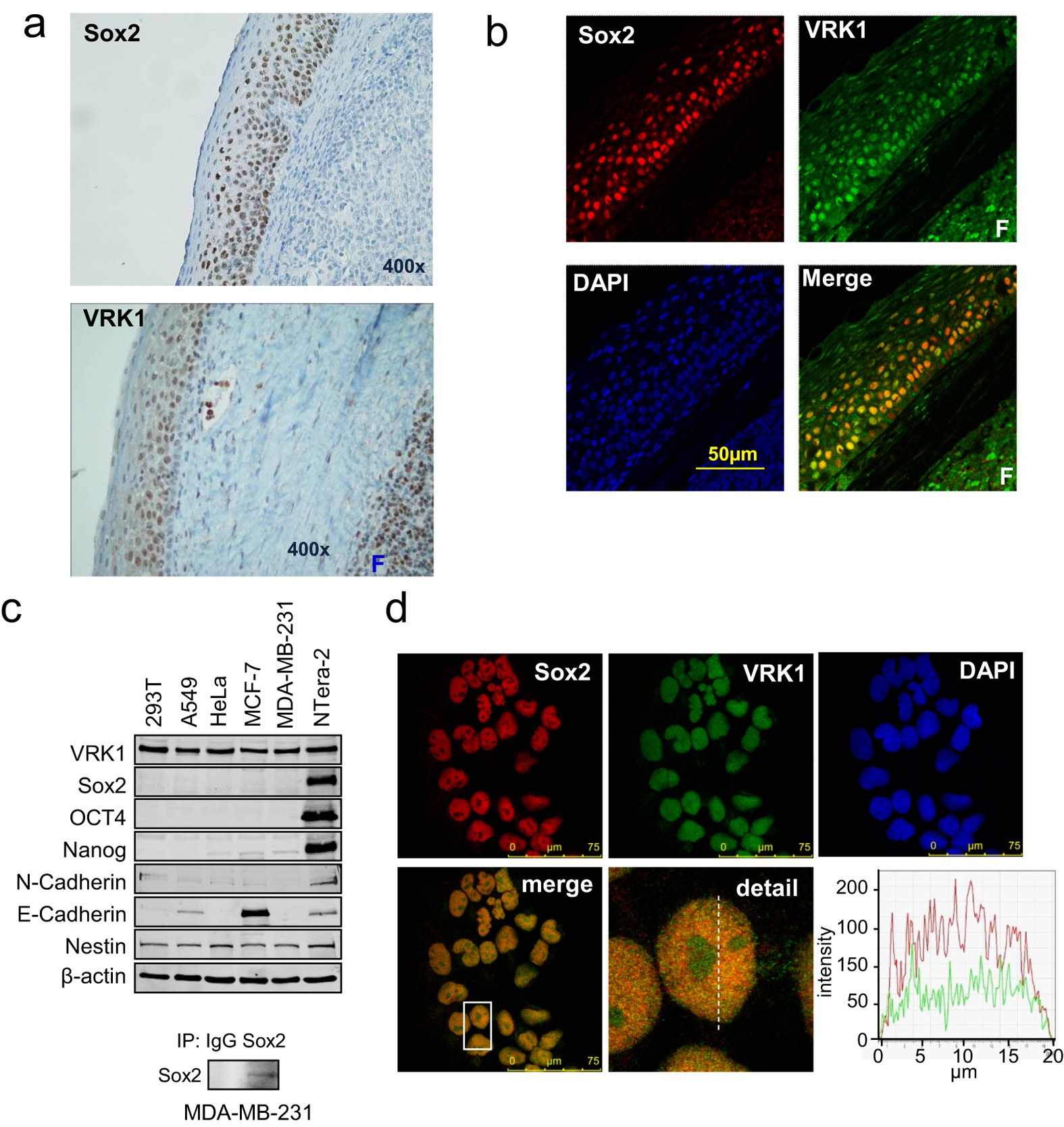 Usual Botany Acquisition Oncogenic Sox2 regulates and cooperates with VRK1 in cell cycle progression  and differentiation | Scientific Reports