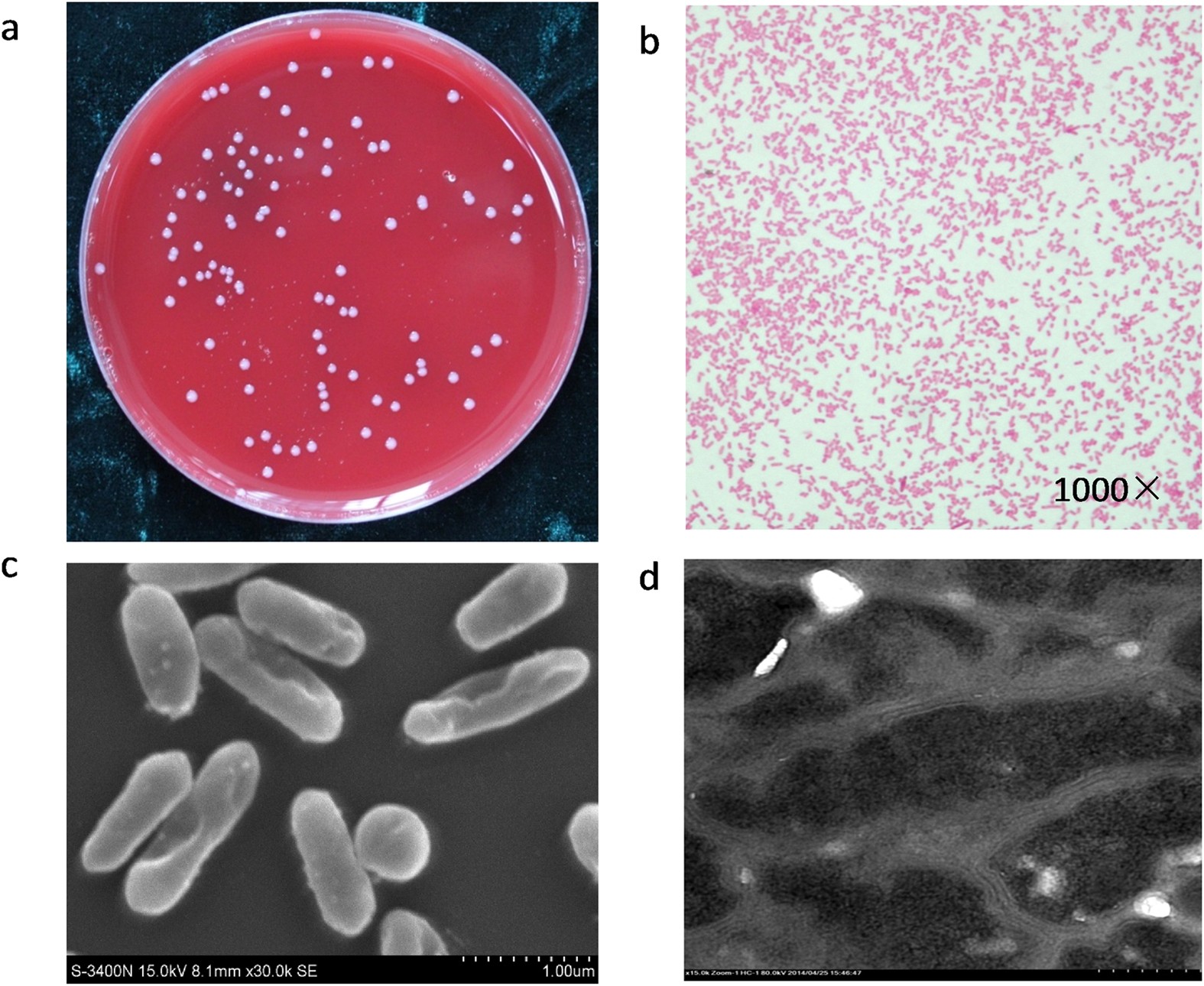 A novel strain of Bacteroides fragilis enhances phagocytosis and polarises  M1 macrophages | Scientific Reports