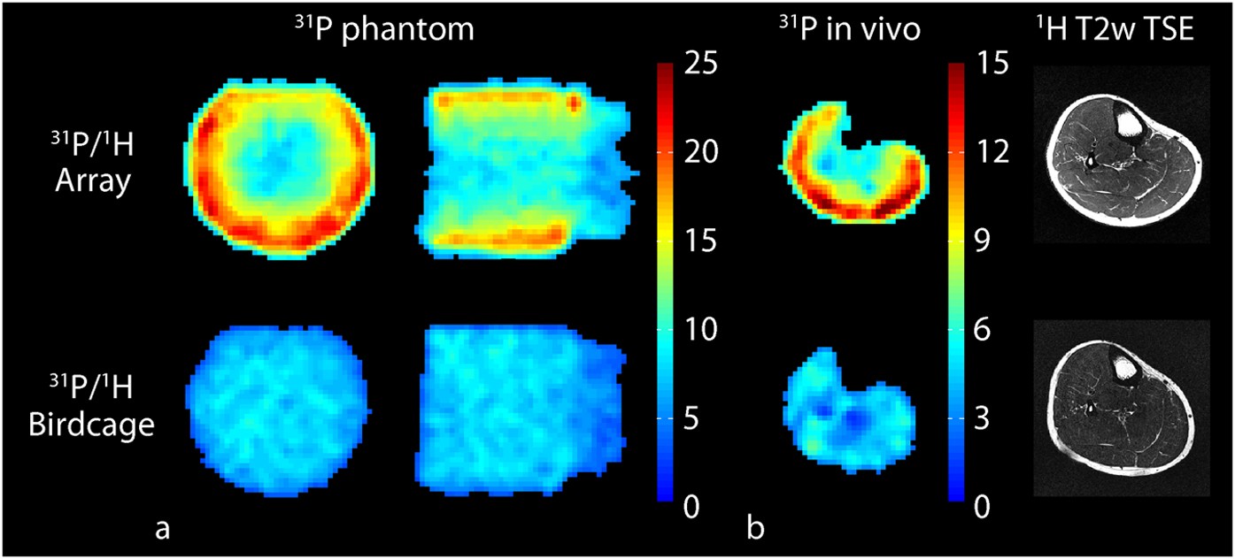 Journal of Magnetic Resonance Imaging: Vol 55, No 1