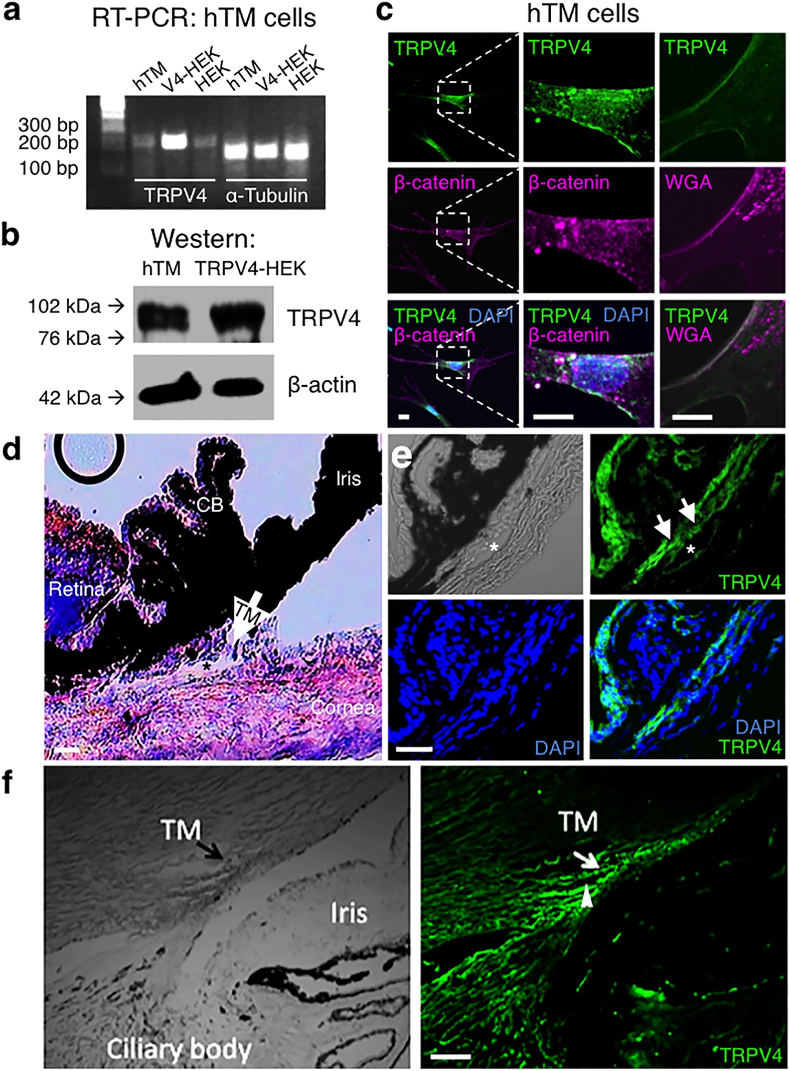 TRPV4 regulates calcium homeostasis, cytoskeletal remodeling, conventional outflow and intraocular pressure in the mammalian eye Scientific Reports