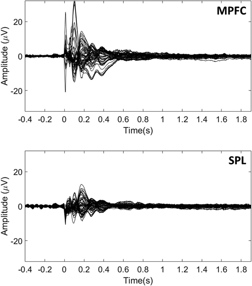 eeg study eeg study