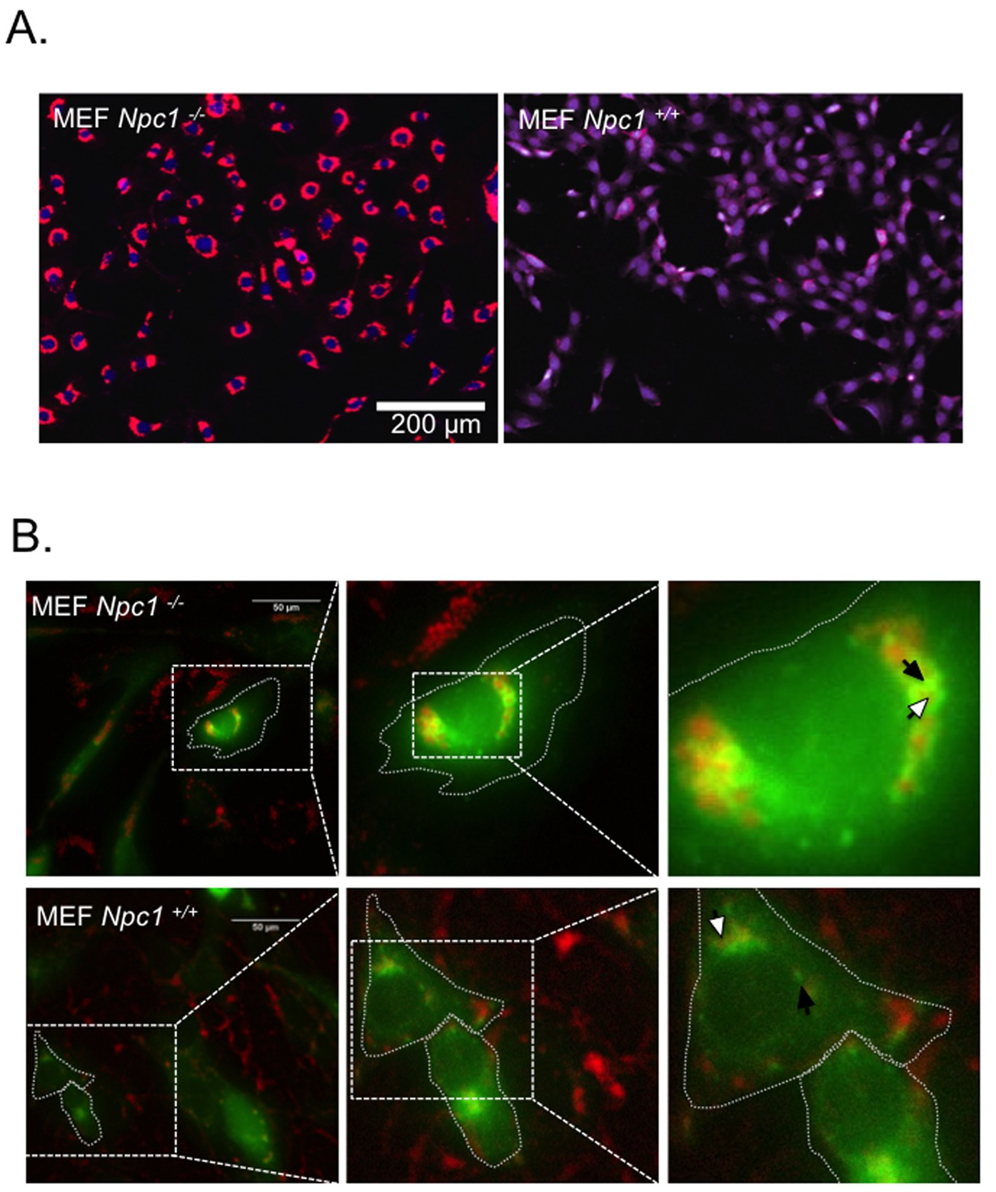 Laboratory diagnosis of Niemann-Pick disease type C: the filipin staining  test.