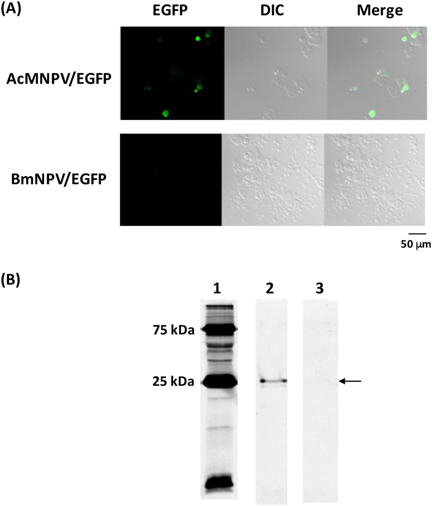 Gene Transduction In Mammalian Cells Using Bombyx Mori Nucleopolyhedrovirus Assisted By Glycoprotein 64 Of Autographa Californica Multiple Nucleopolyhedrovirus Scientific Reports Gene Transduction In Mammalian Cells Using Bombyx Mori Nucleopolyhedrovirus Assisted By Glycoprotein 64 Of Autographa Californica Multiple Nucleopolyhedrovirus Scientific Reports