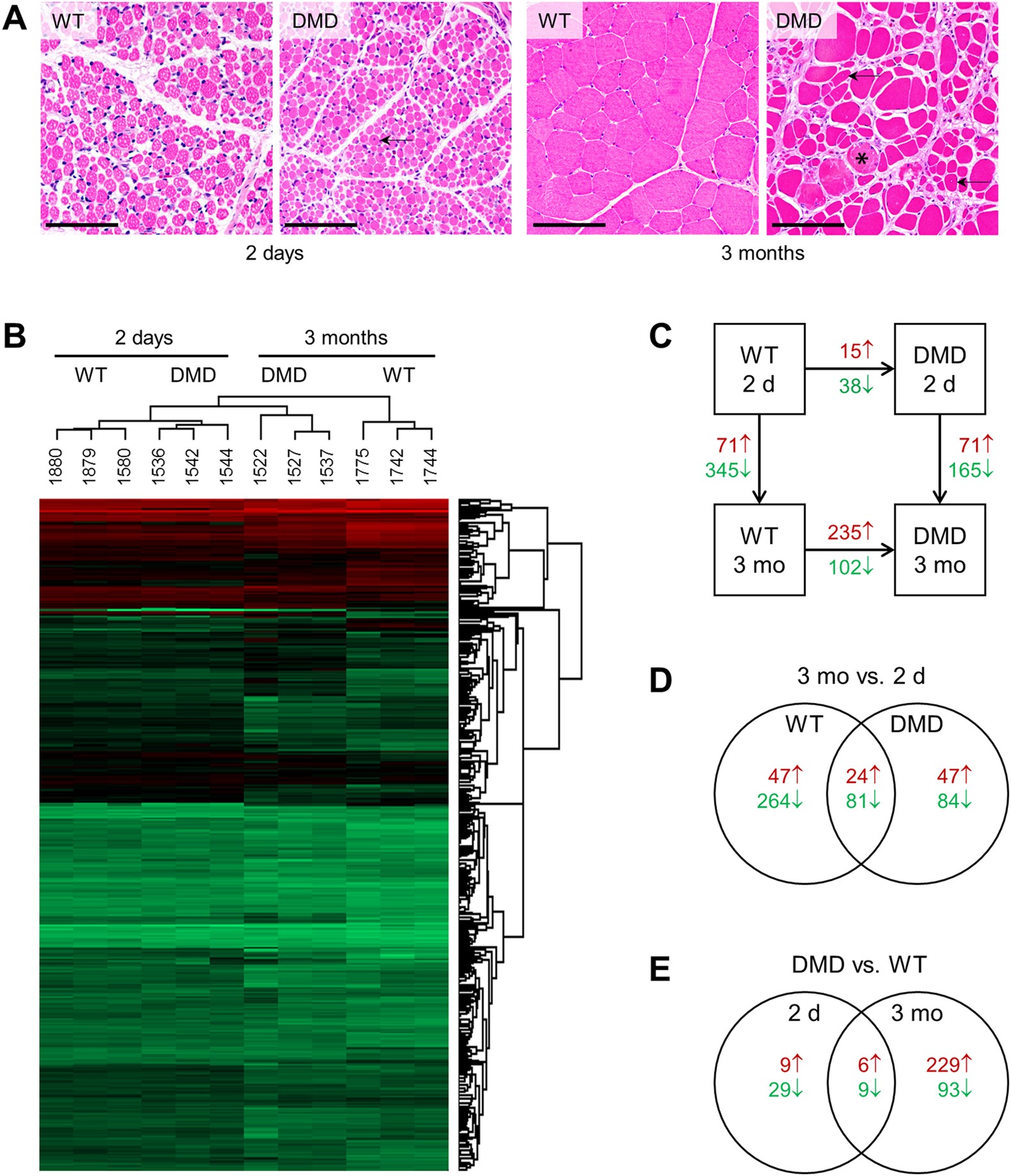 Progressive muscle proteome changes in a clinically relevant pig model of  Duchenne muscular dystrophy | Scientific Reports