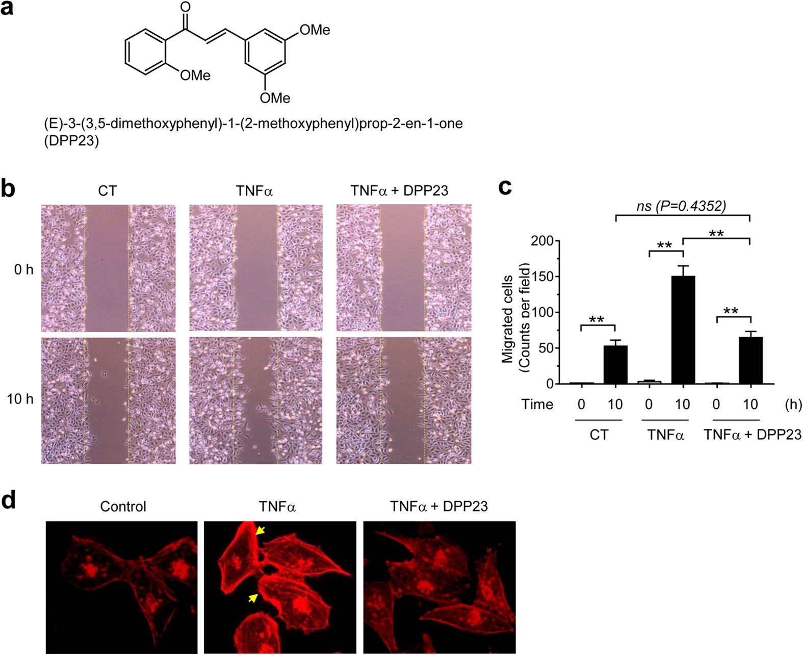 The UPR inducer DPP23 inhibits the metastatic potential of MDA-MB-231 human  breast cancer cells by targeting the Akt–IKK–NF-κB–MMP-9 axis | Scientific  Reports