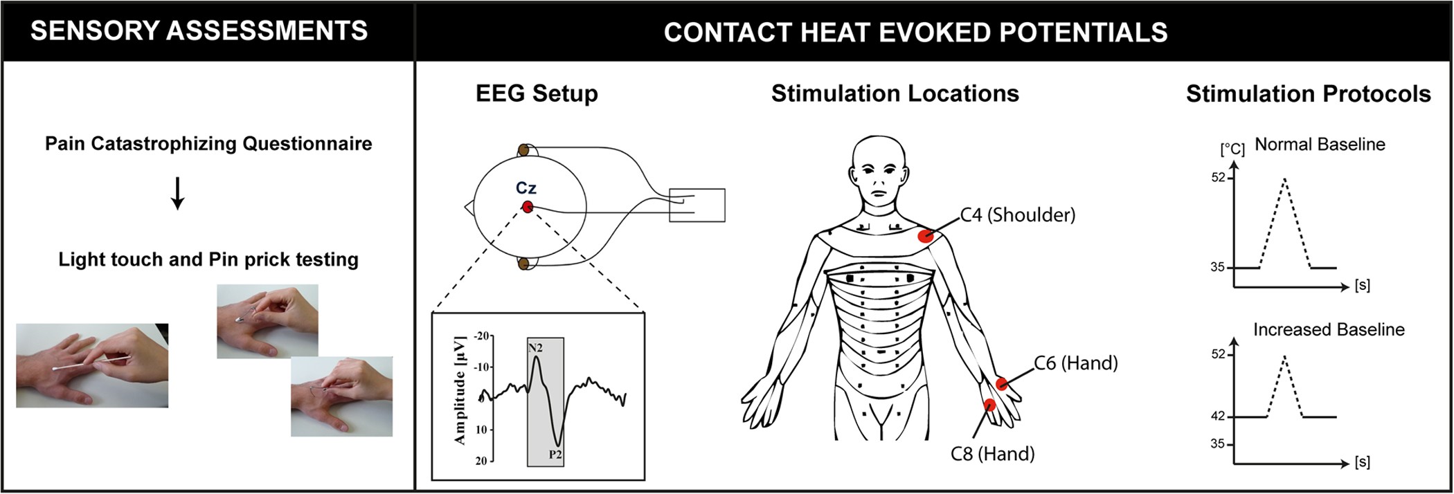 Normative data for the segmental acquisition of contact heat evoked potentials in cervical dermatomes Scientific Reports pic