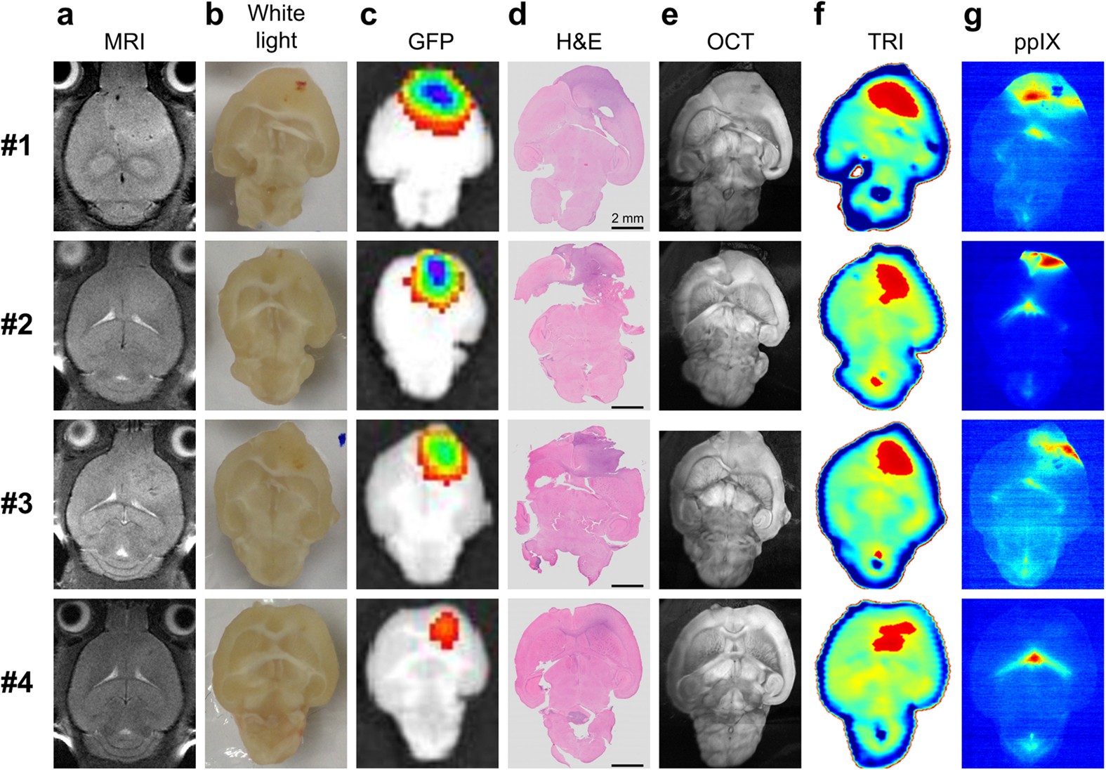 Terahertz Reflectometry Imaging For Low And High Grade Gliomas Scientific Reports Terahertz Reflectometry Imaging For Low And High Grade Gliomas Scientific Reports