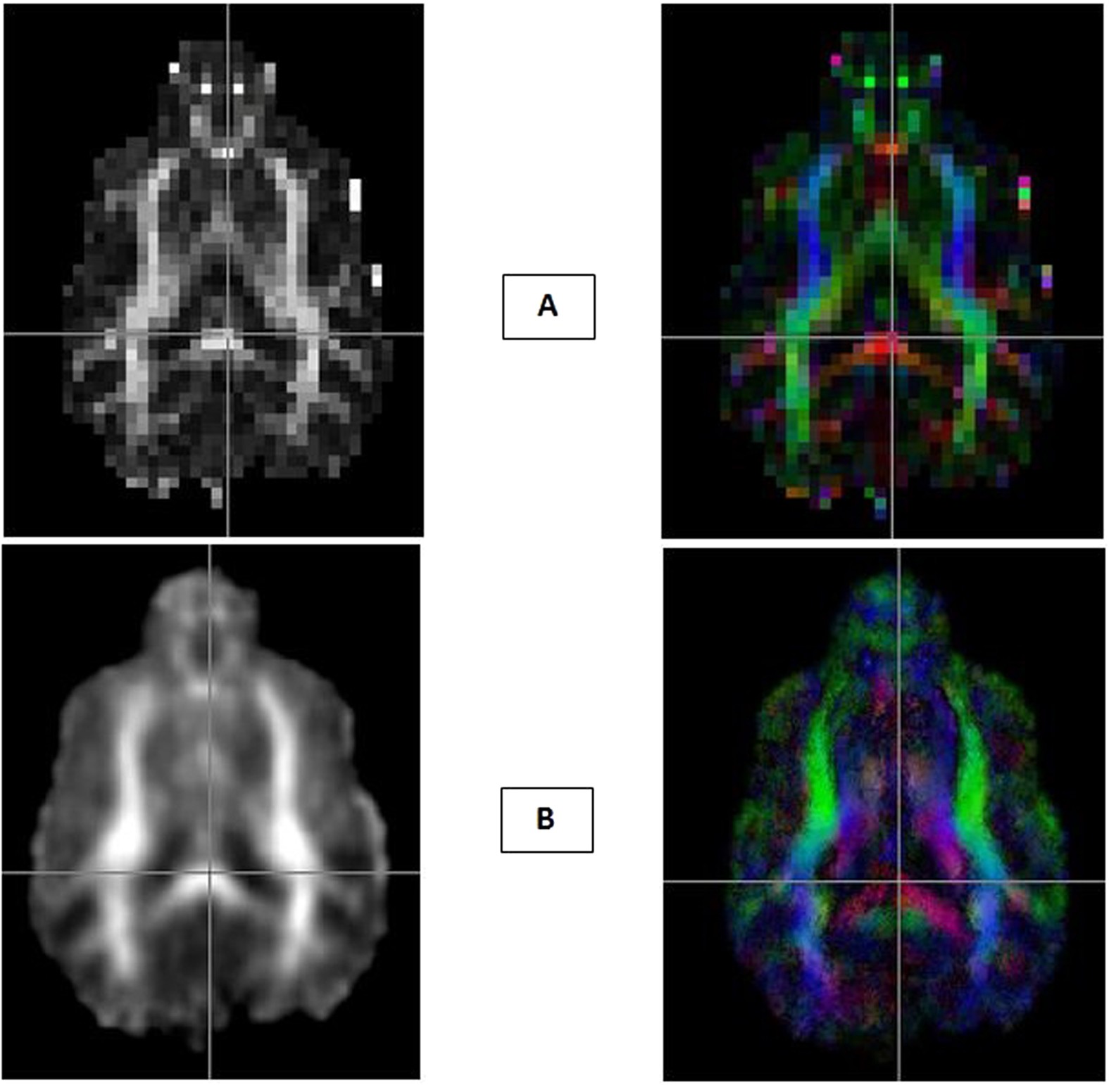 Characterization of Structural Connectivity of the Default Mode Network in  Dogs using Diffusion Tensor Imaging | Scientific Reports