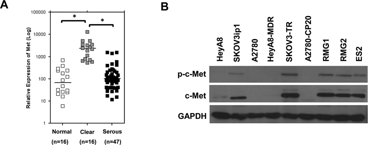 C Met As A Potential Therapeutic Target In Ovarian Clear Cell