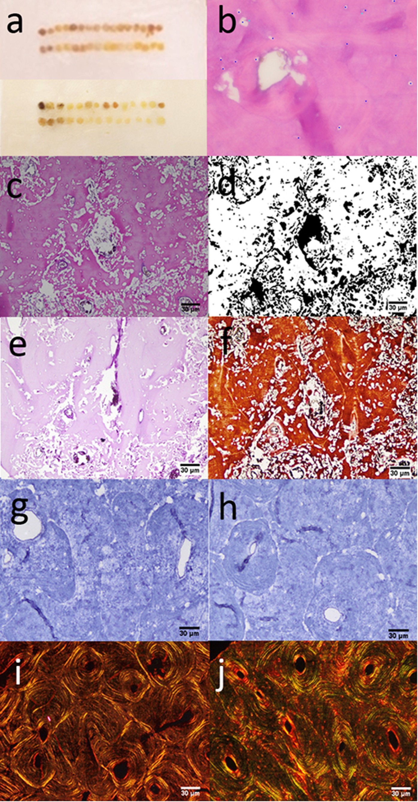 Tissue Microarray Analysis Applied to Bone Diagenesis | Scientific Reports