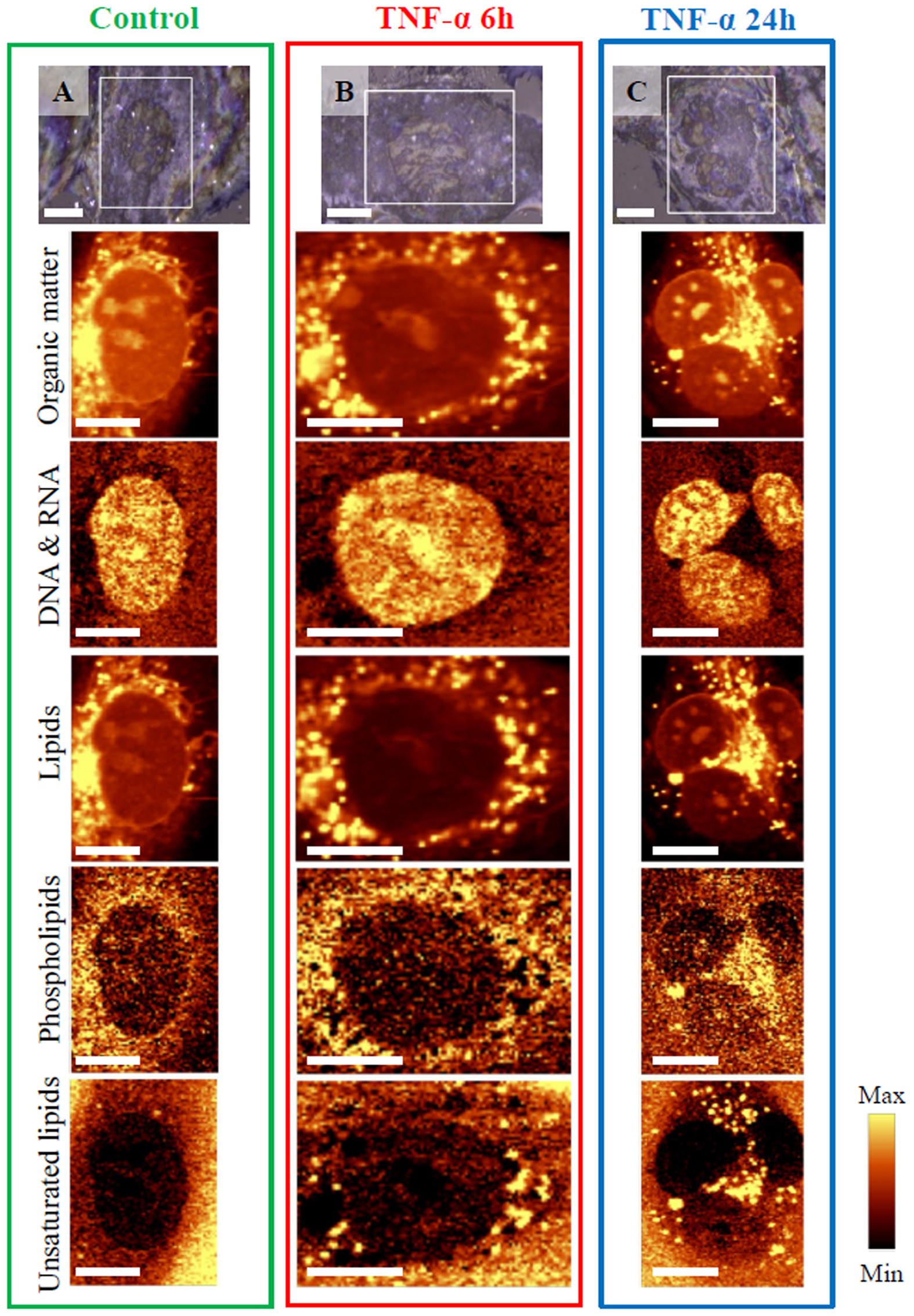 Unsaturated lipid bodies as a hallmark of inflammation studied by Raman 2D  and 3D microscopy | Scientific Reports