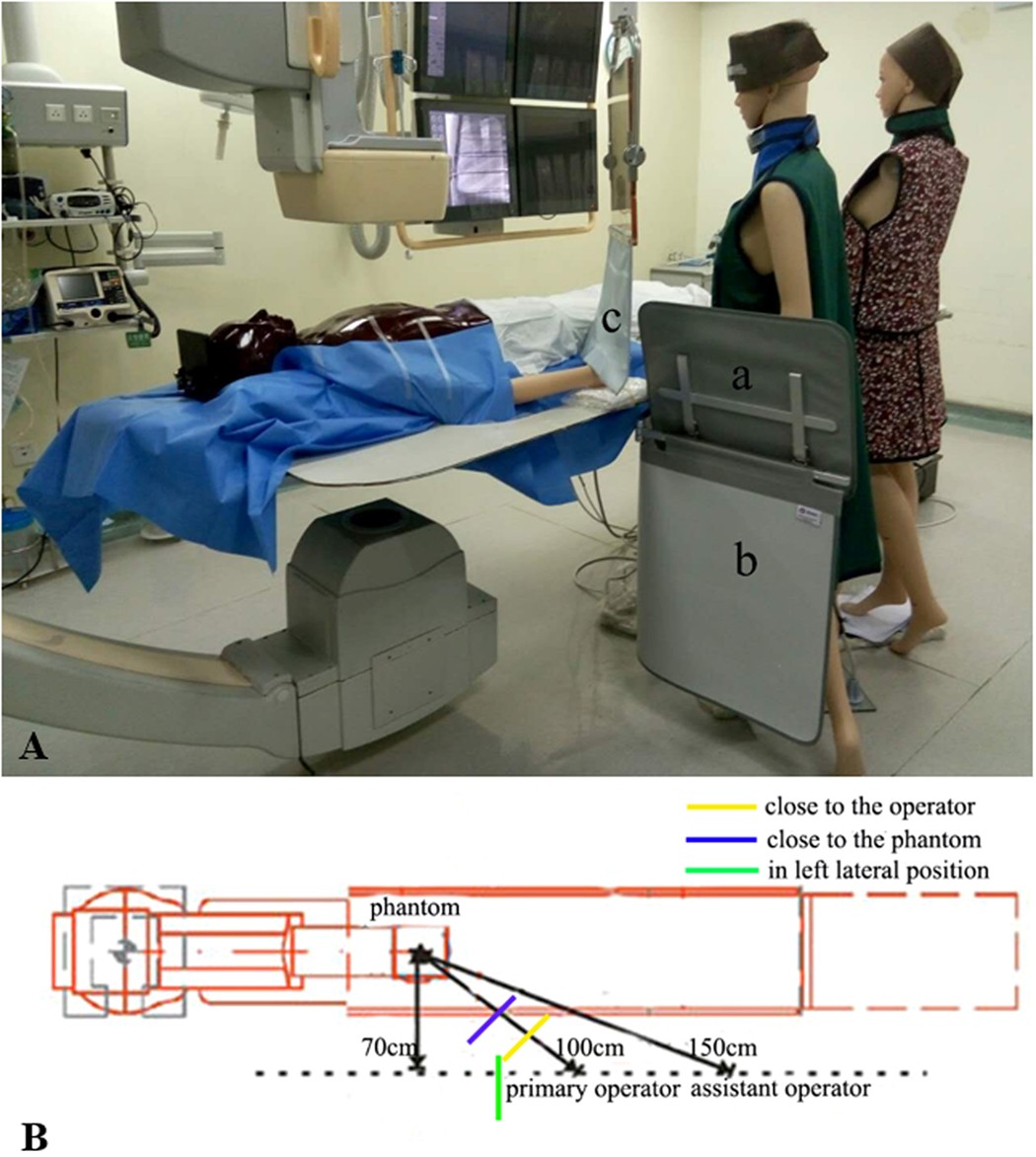 Operator Radiation and the Efficacy of Ceiling-Suspended Lead Screen  Shielding during Coronary Angiography: An Anthropomorphic Phantom Study  Using Real-Time Dosimeters | Scientific Reports