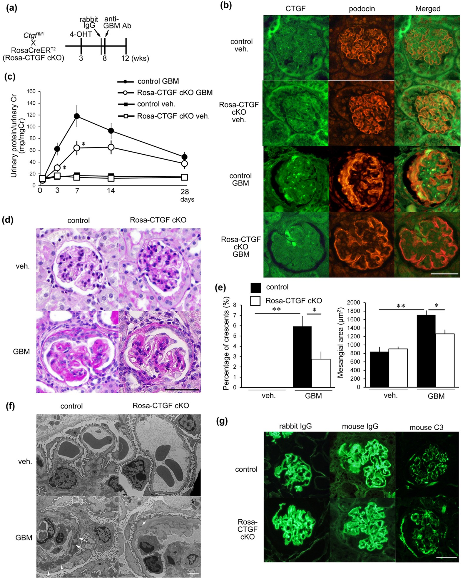 Crucial Role of Mesangial Cell-derived Connective Tissue Growth Factor in a  Mouse Model of Anti-Glomerular Basement Membrane Glomerulonephritis |  Scientific Reports