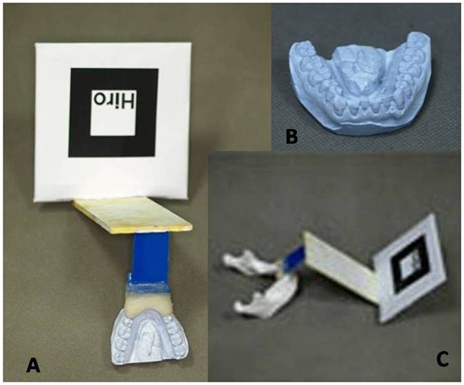 Figure 3: Fabricated dental cast, occlusal splint and cement with the tracking marker.